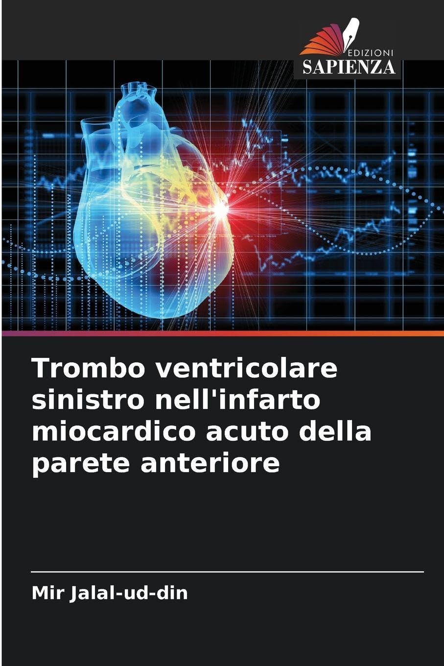 Trombo ventricolare sinistro nell'infarto miocardico acuto della parete anteriore Medicine