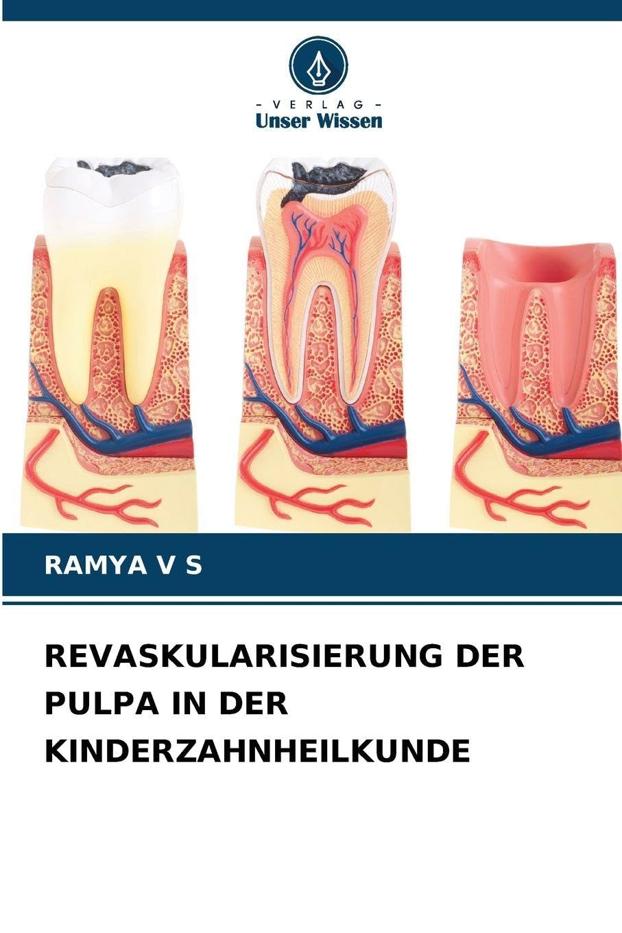REVASKULARISIERUNG DER PULPA IN DER KINDERZAHNHEILKUNDE Medicine
