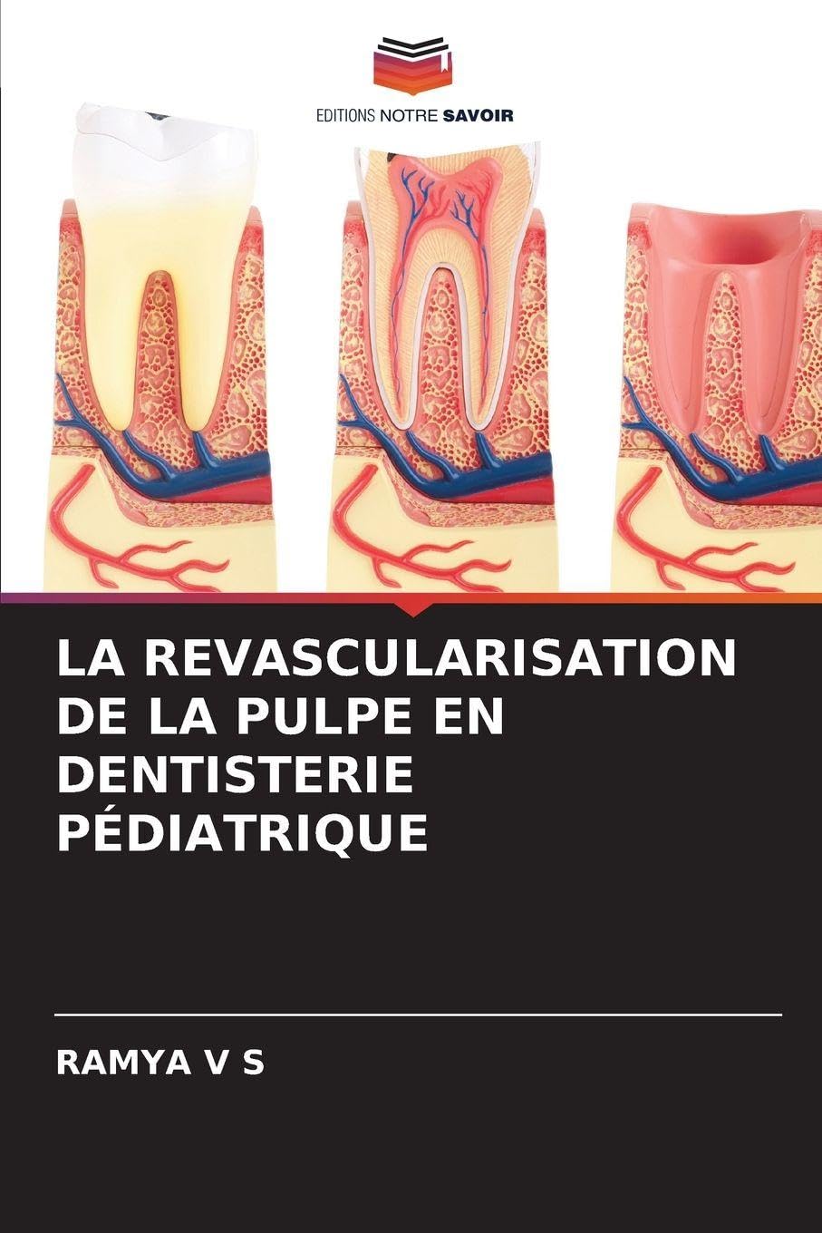 LA REVASCULARISATION DE LA PULPE EN DENTISTERIE PÉDIATRIQUE Medicine