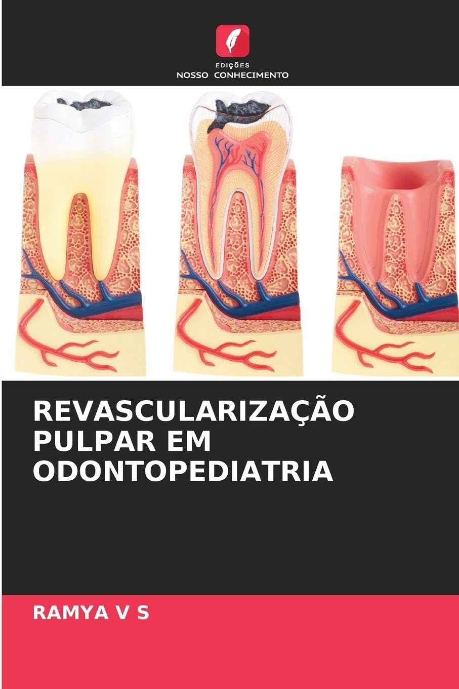 REVASCULARIZAÇÃO PULPAR EM ODONTOPEDIATRIA Medicine