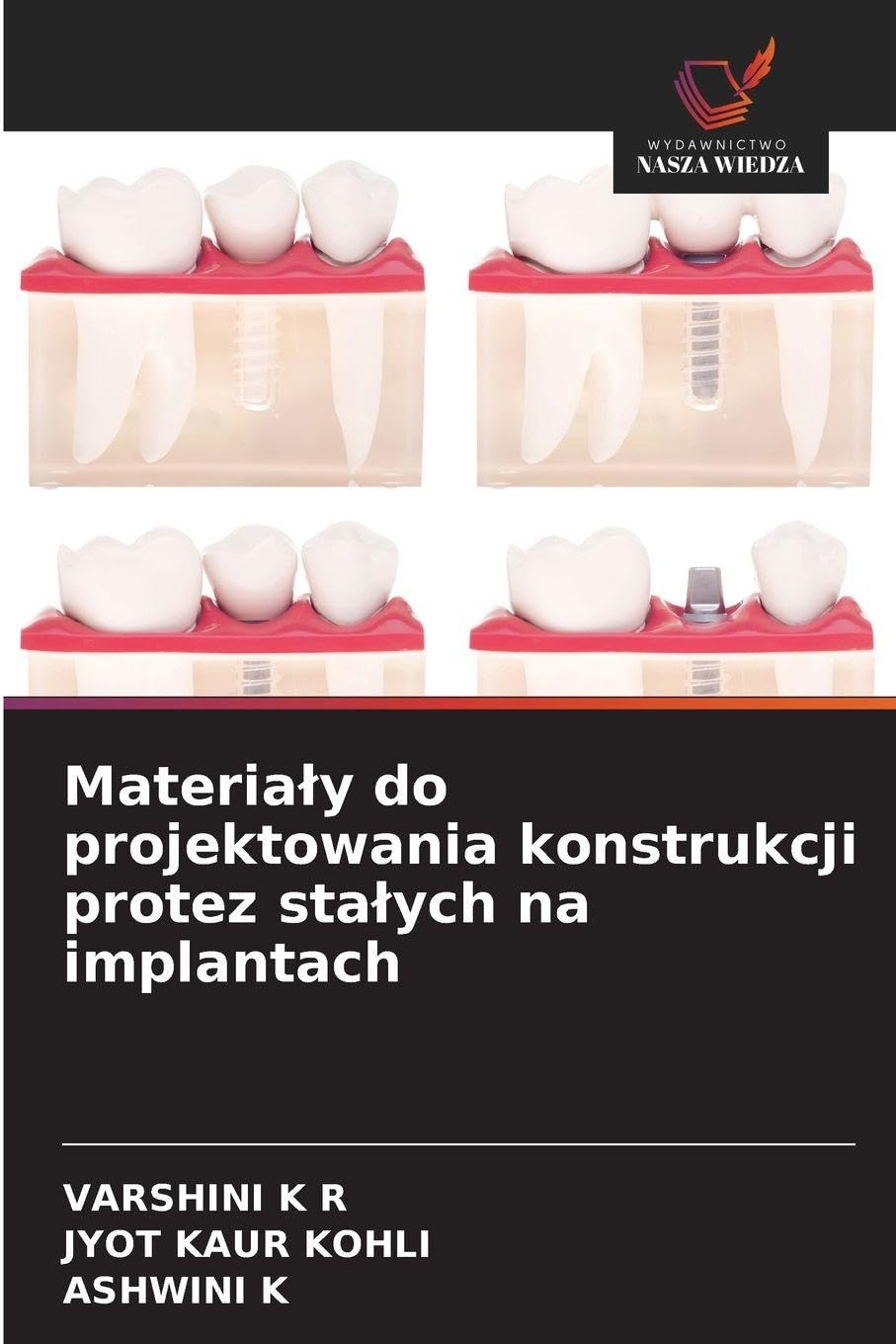 Materia¿y do projektowania konstrukcji protez sta¿ych na implantach Medicine