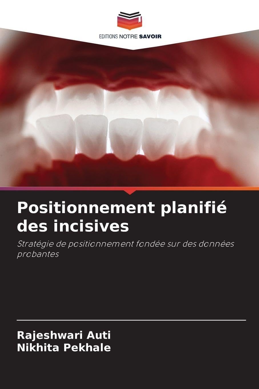Positionnement planifié des incisives Medicine