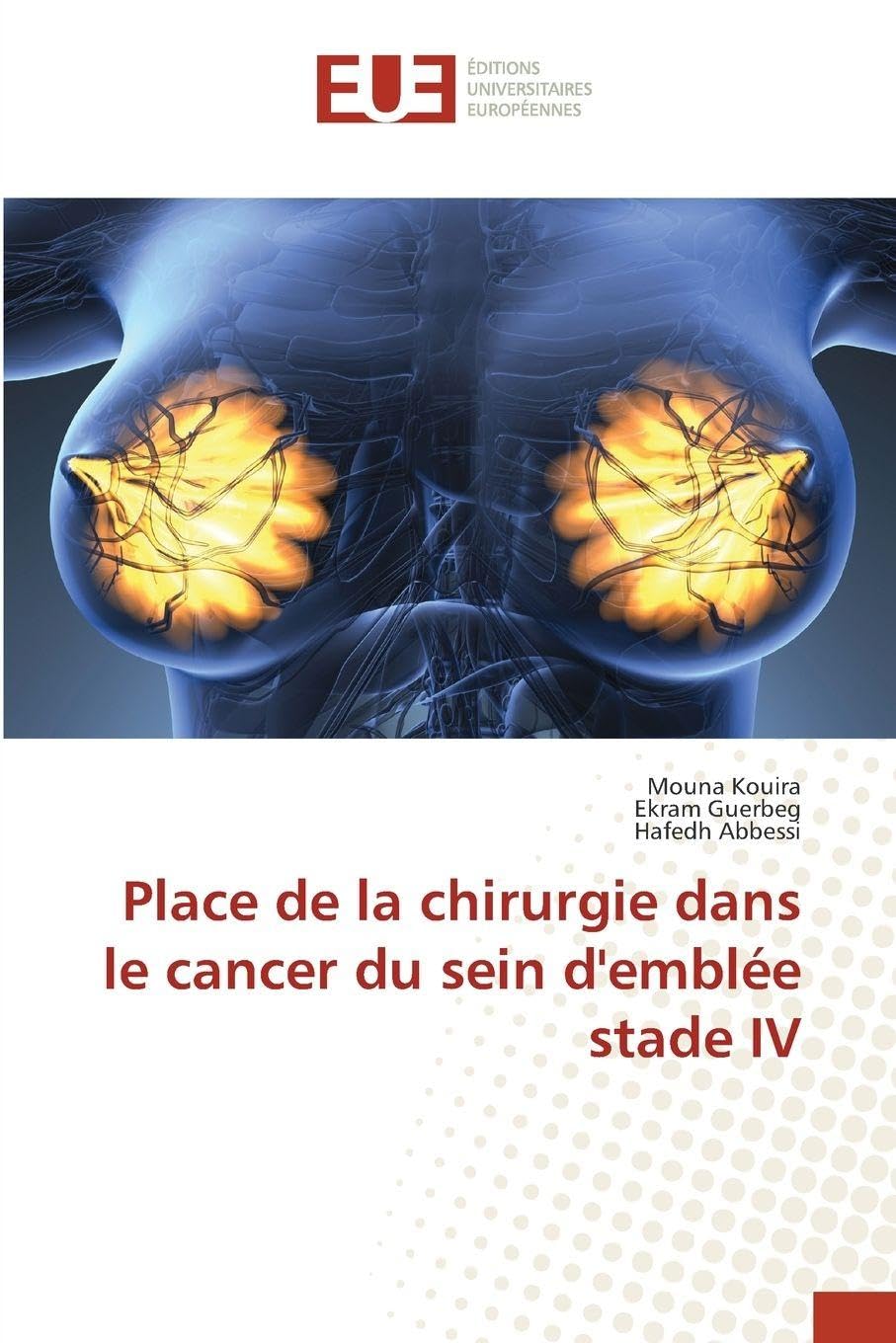 Place de la chirurgie dans le cancer du sein d'emblée stade IV Medicine