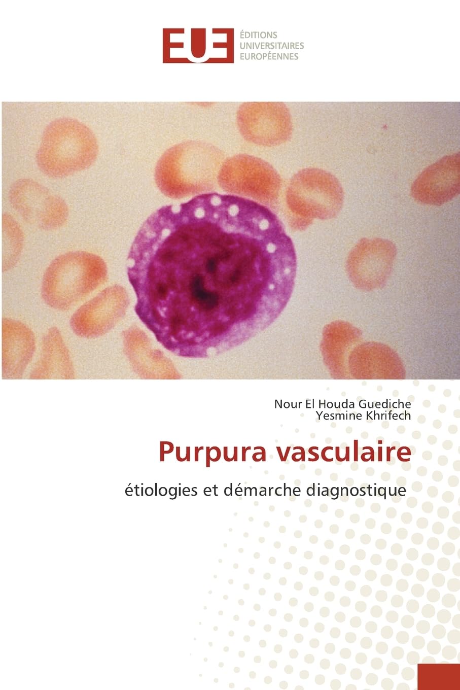 Purpura vasculaire Medicine