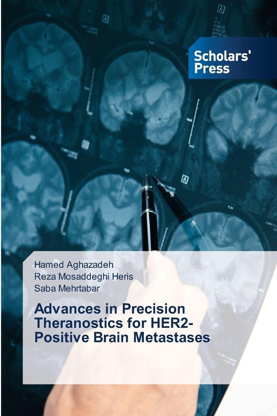 Advances in Precision Theranostics for HER2-Positive Brain Metastases Medicine