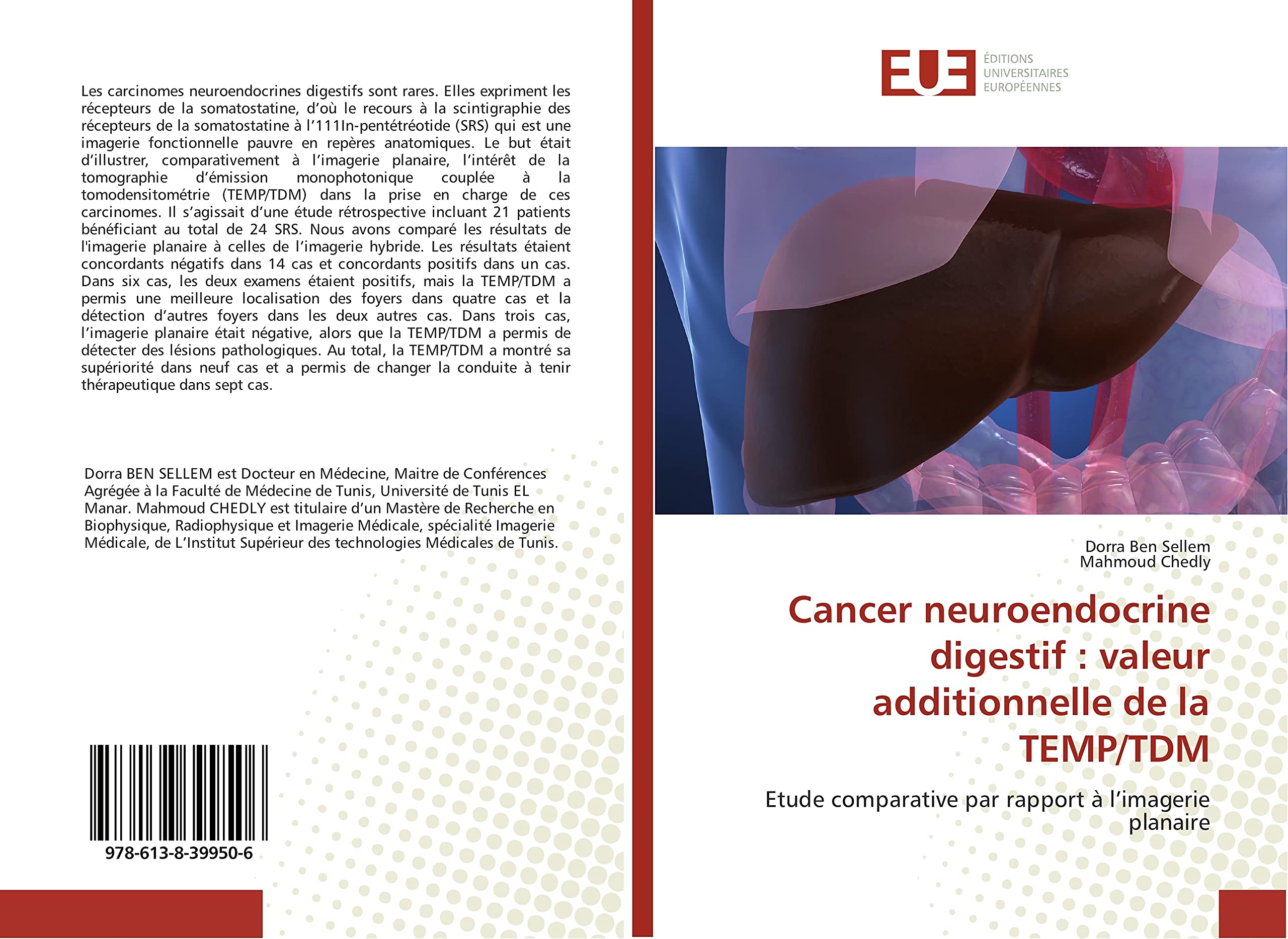 Cancer neuroendocrine digestif : valeur additionnelle de la TeMP/TDM: Etude comparative par rapport A l'imagerie planaire book
