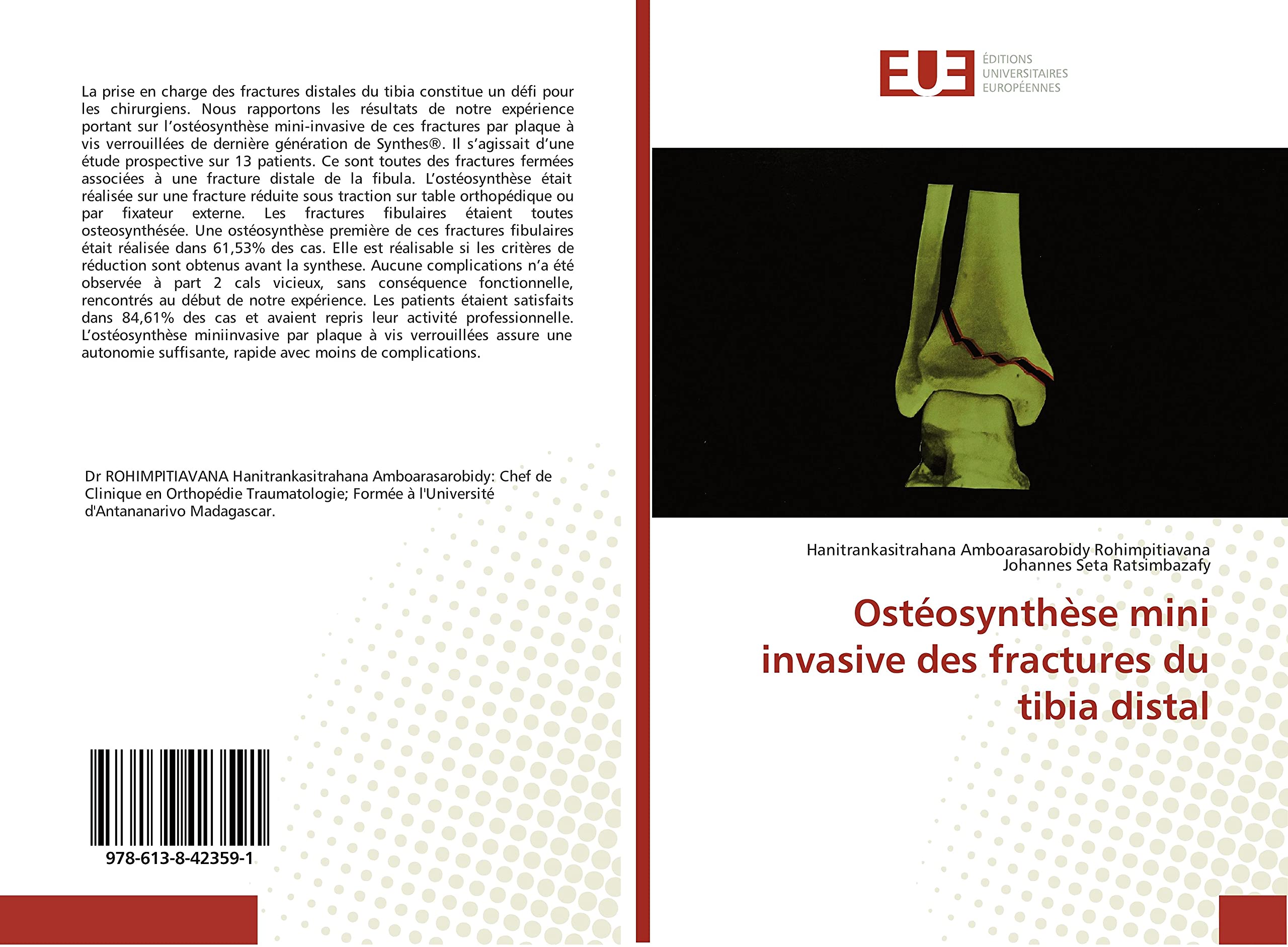 OsteoSynthèse mini invasive des fractures du tibia distal book
