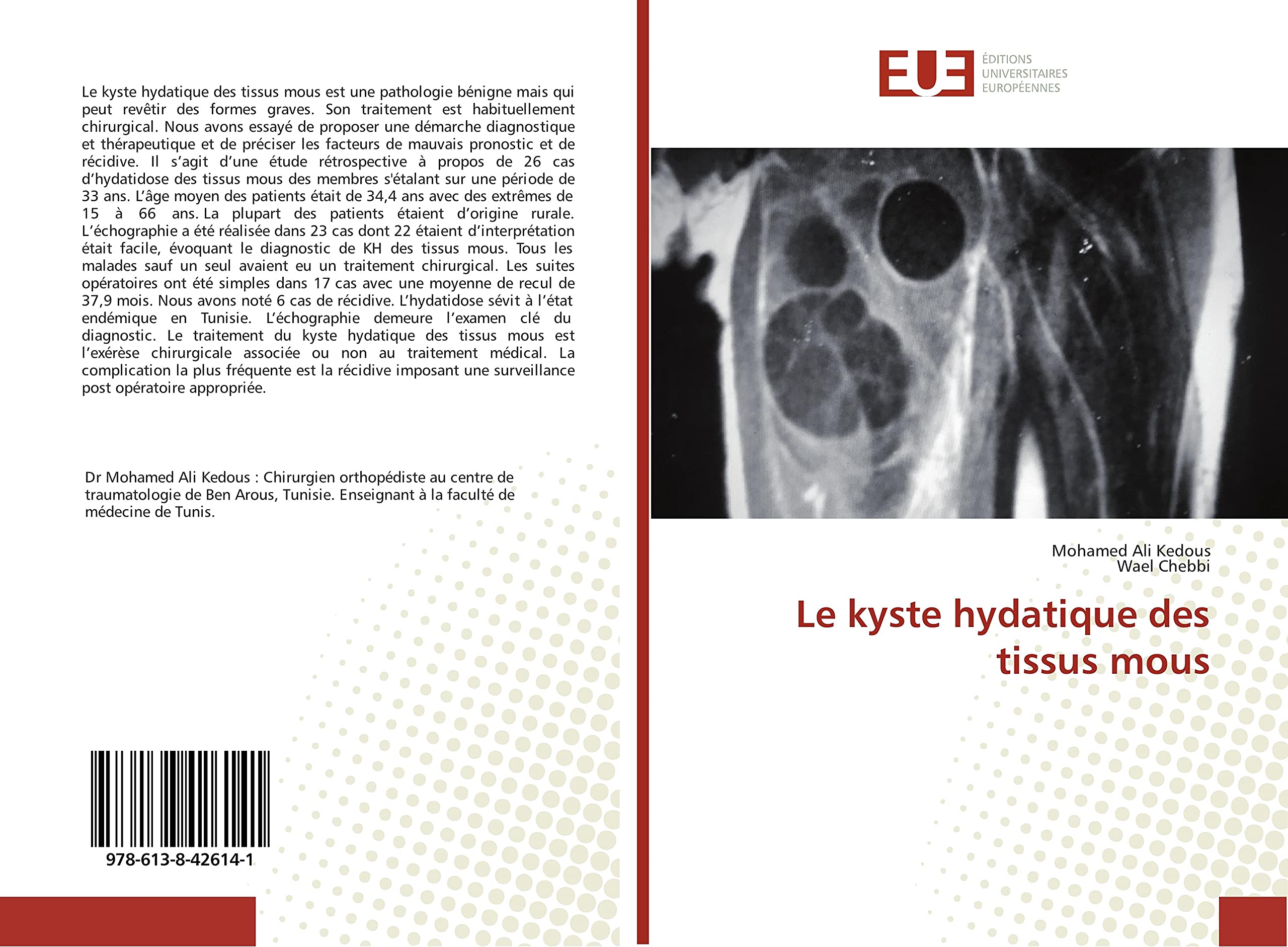 Le kyste hydatique des tissus mous book