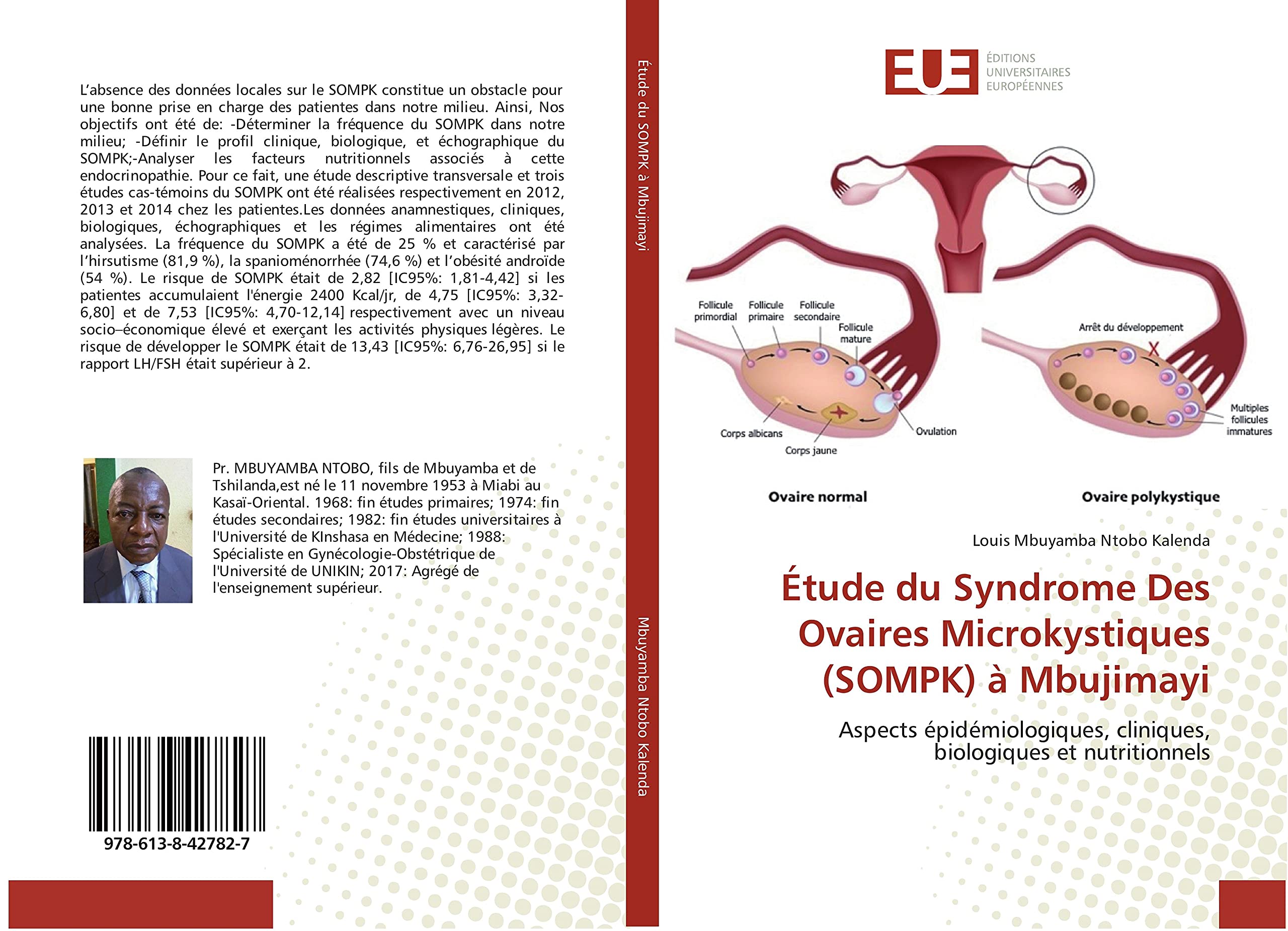 etude du Syndrome Des Ovaires Microkystiques (SOMPK) a Mbujimayi book