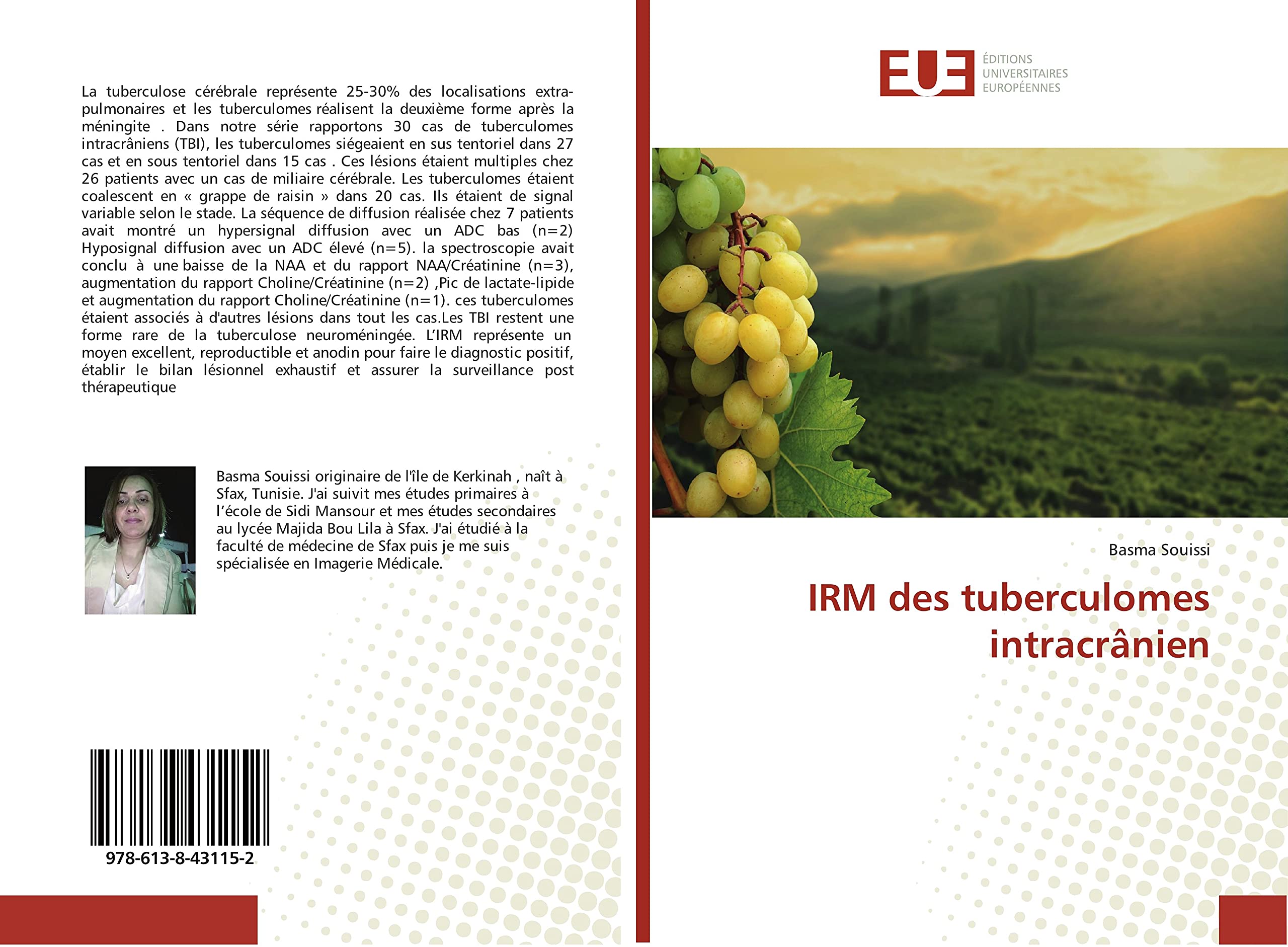 IRM des tuberculomes intracranien: Structure et Metabolisme book