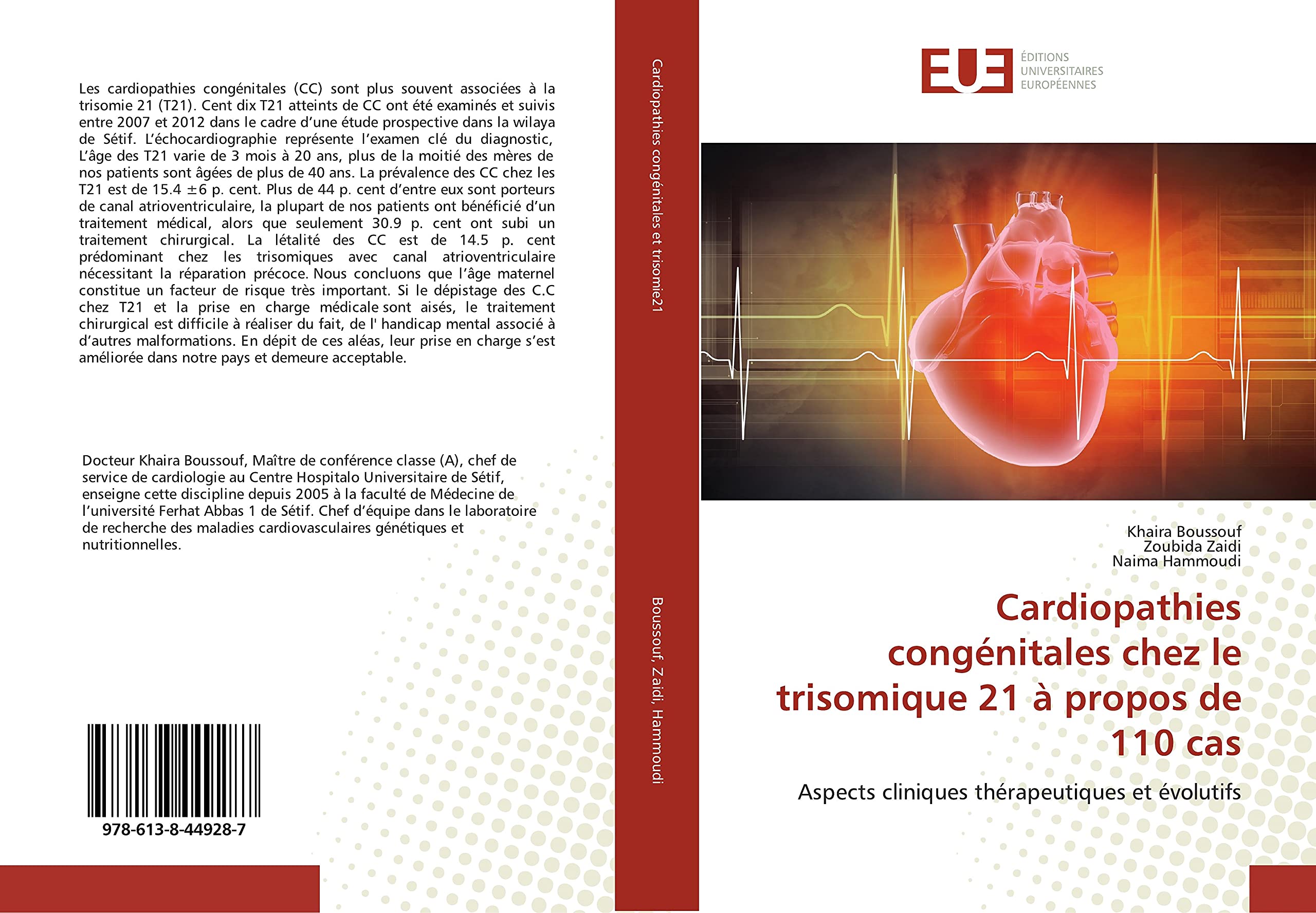 Cardiopathies congénitales chez le trisomique 21 à propos de 110 cas: Aspects cliniques thérapeutiques et évolutifs book