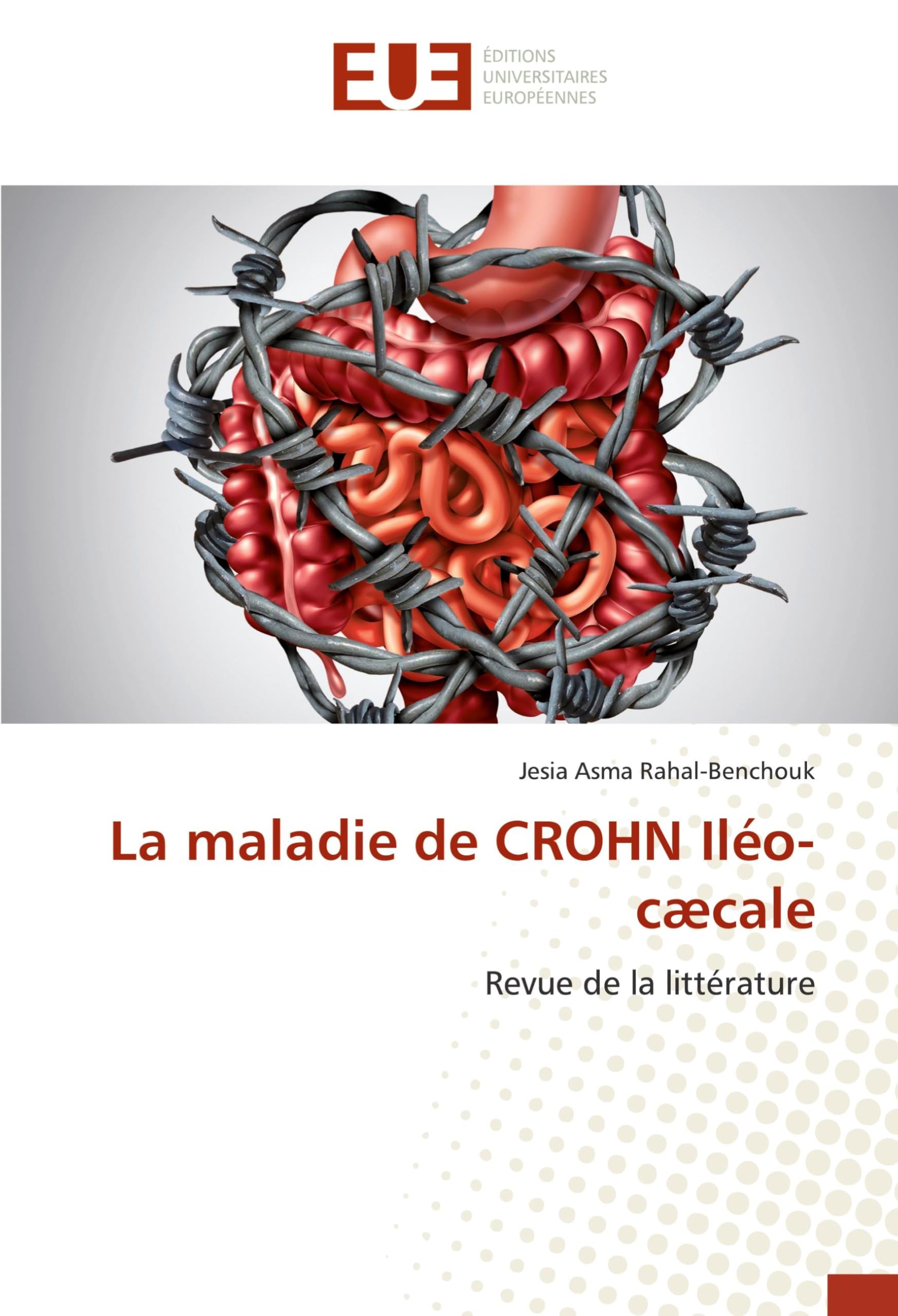 La maladie de CROHN Iléo-cæcale: Revue de la littérature book