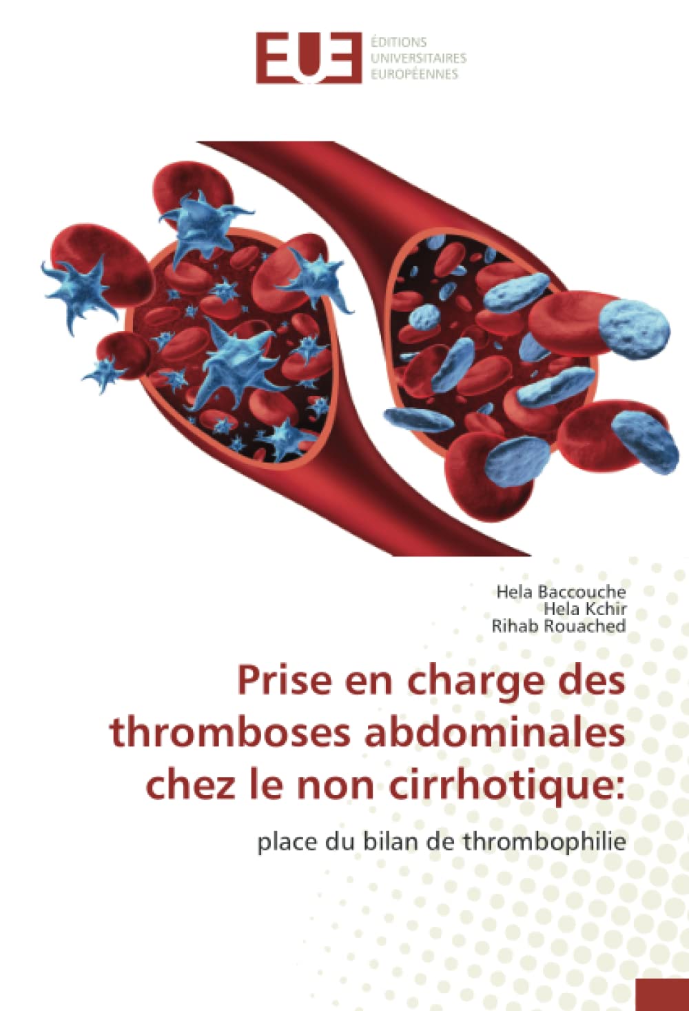 Prise en charge des thromboses abdominales chez le non cirrhotique:: place du bilan de thrombophilie book