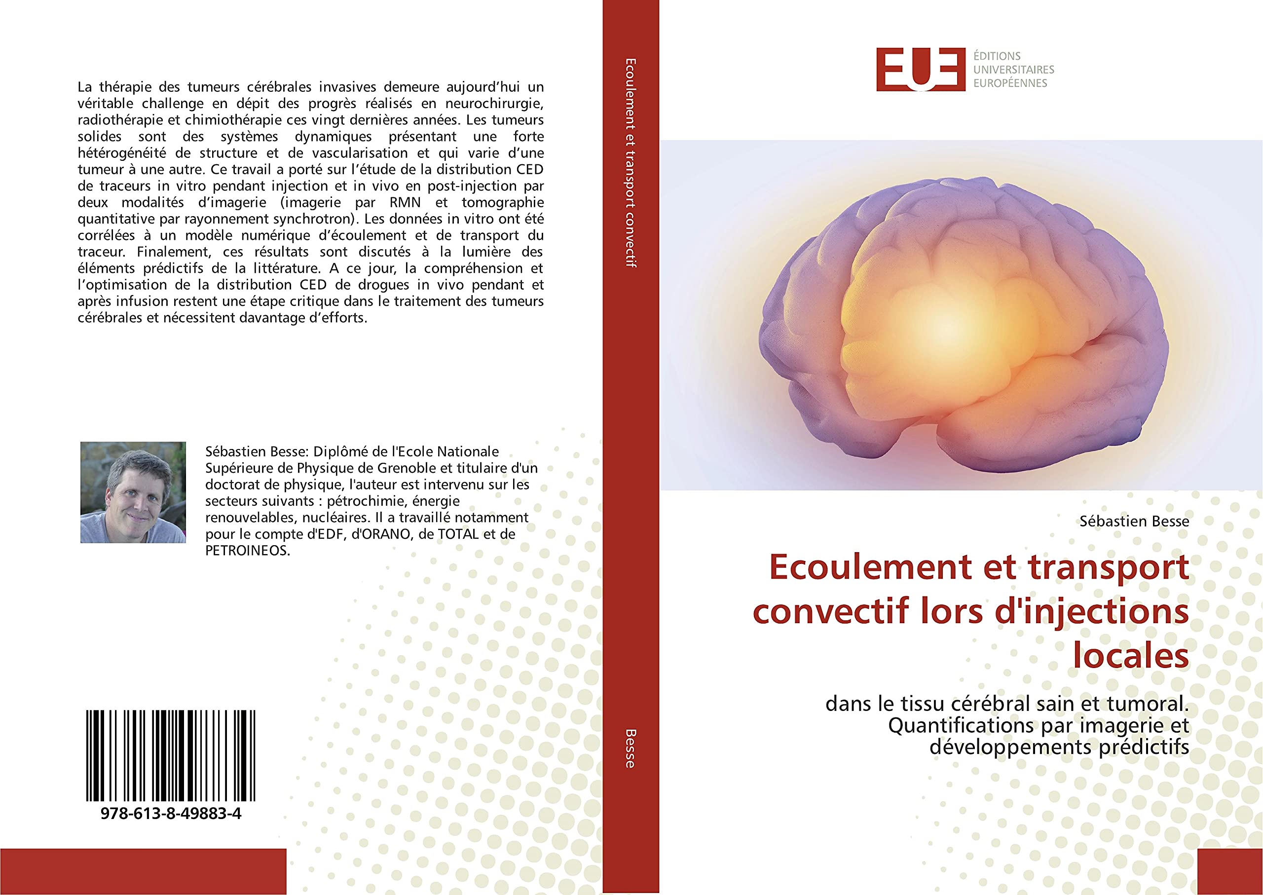 Ecoulement et transport convectif lors d'injections locales: dans le tissu cérébral sain et tumoral. Quantifications par imagerie et développements prédictifs book