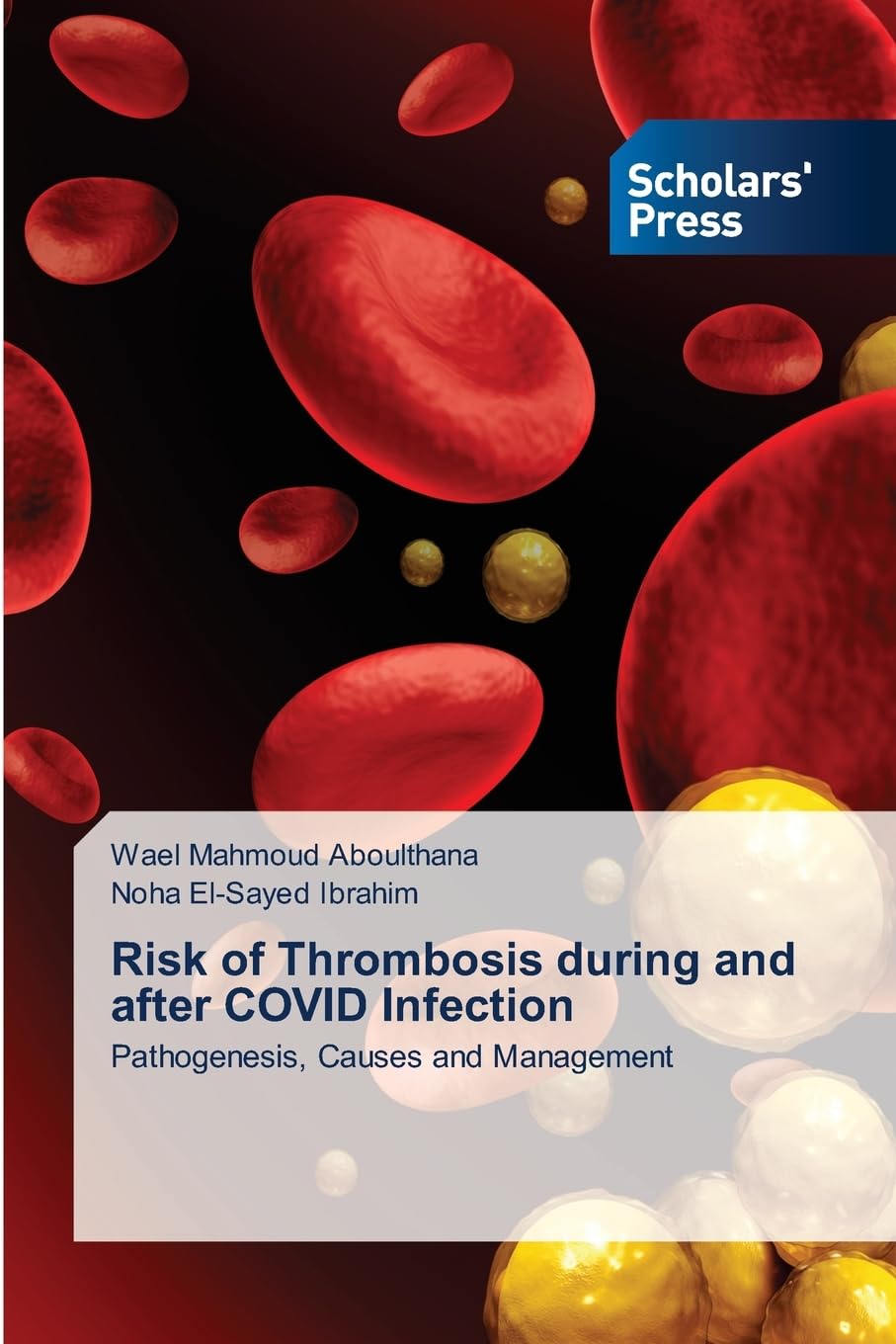 Risk of Thrombosis during and after COVID Infection Natural Sciences