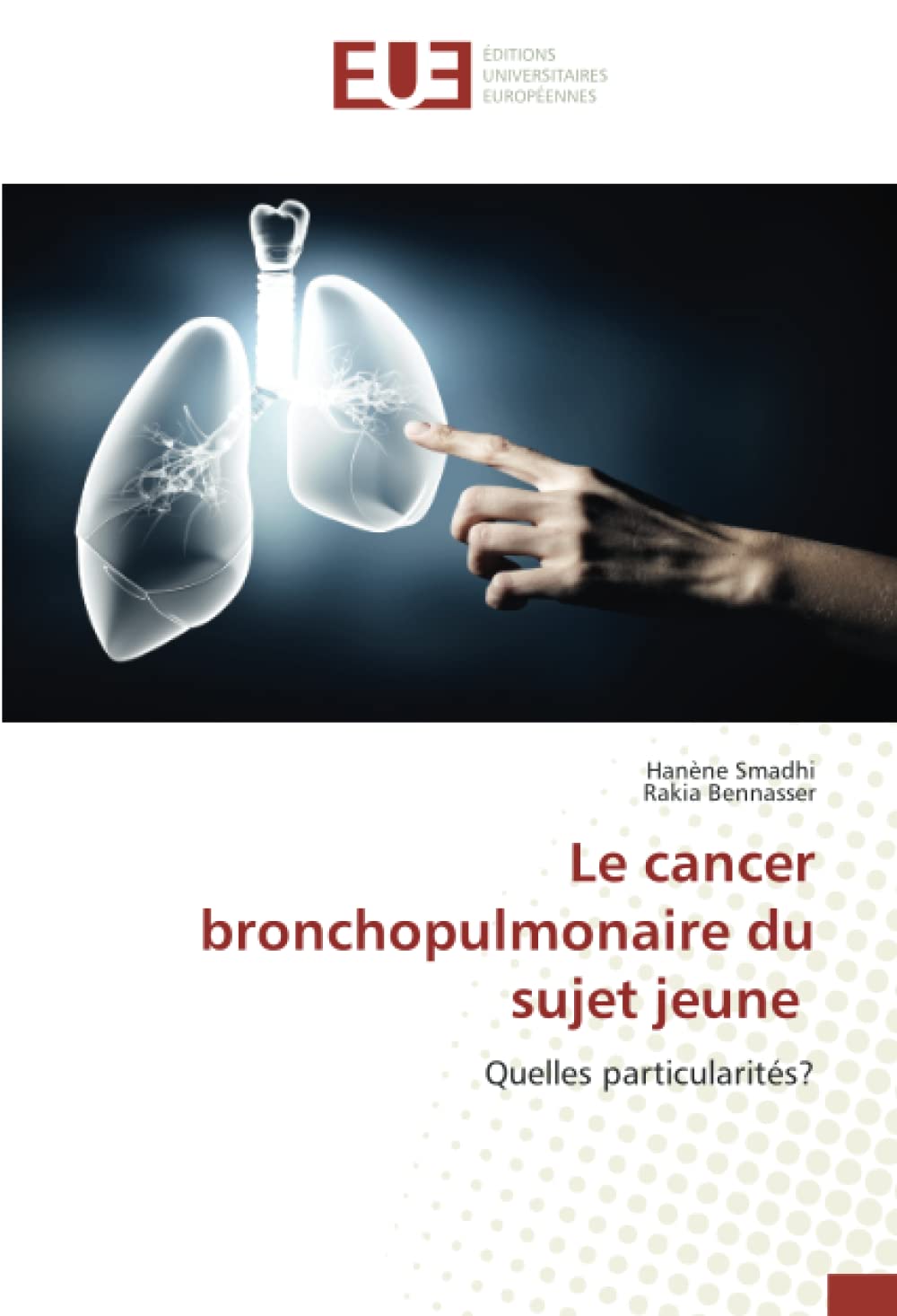 Le cancer bronchopulmonaire du sujet jeune: Quelles particularités? book