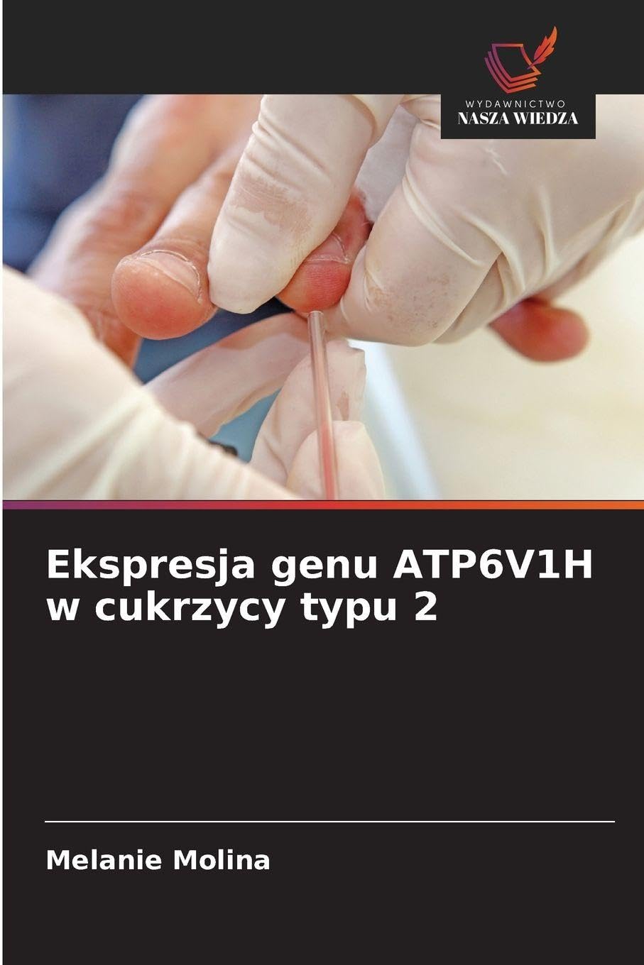 Ekspresja genu ATP6V1H w cukrzycy typu 2 Natural Sciences