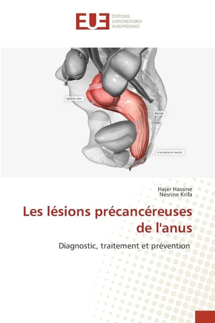 Les lésions précancéreuses de l'anus Medicine