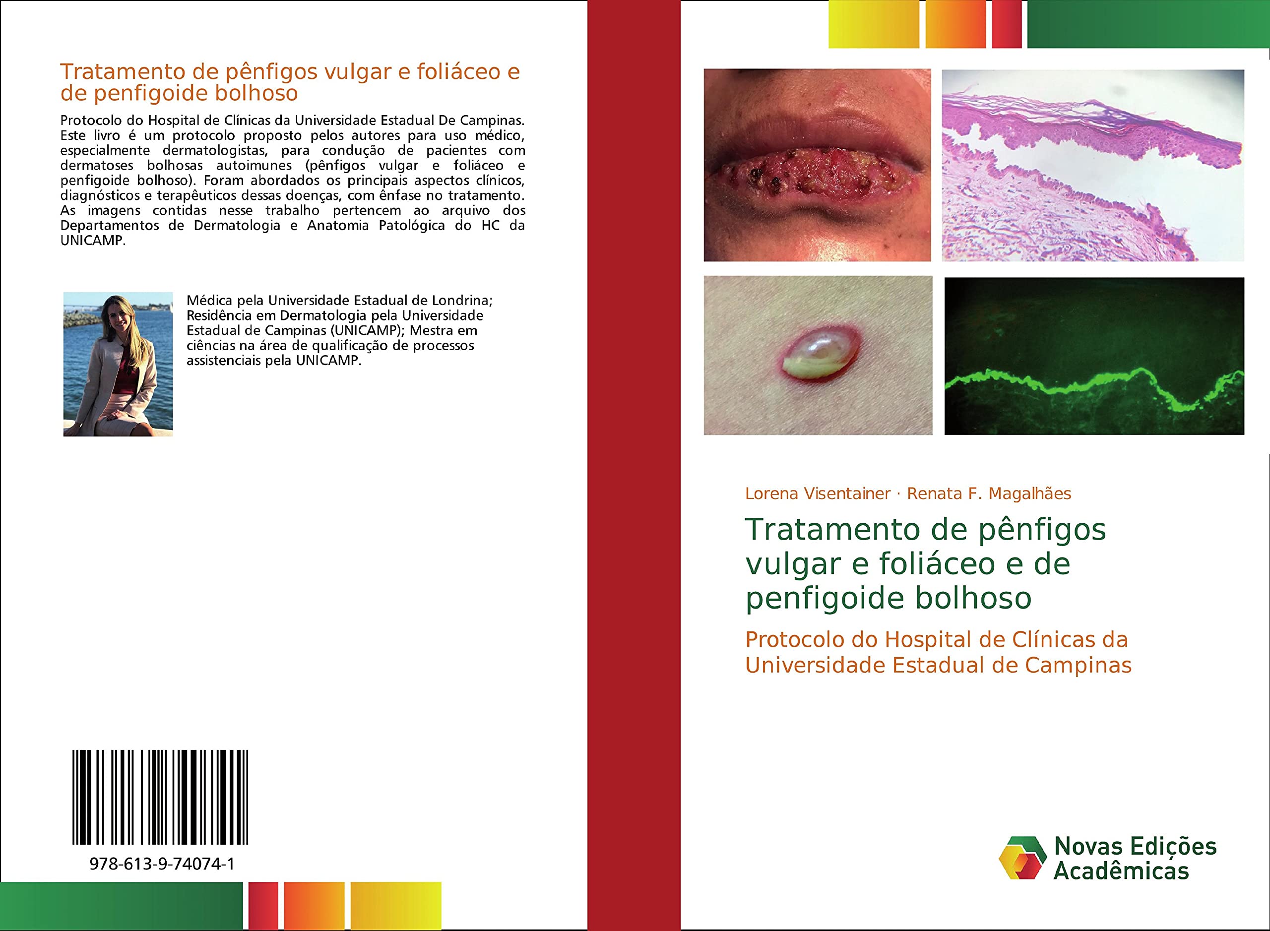 Tratamento de pnfigos vulgar e foliceo e de penfigoide bolhoso book