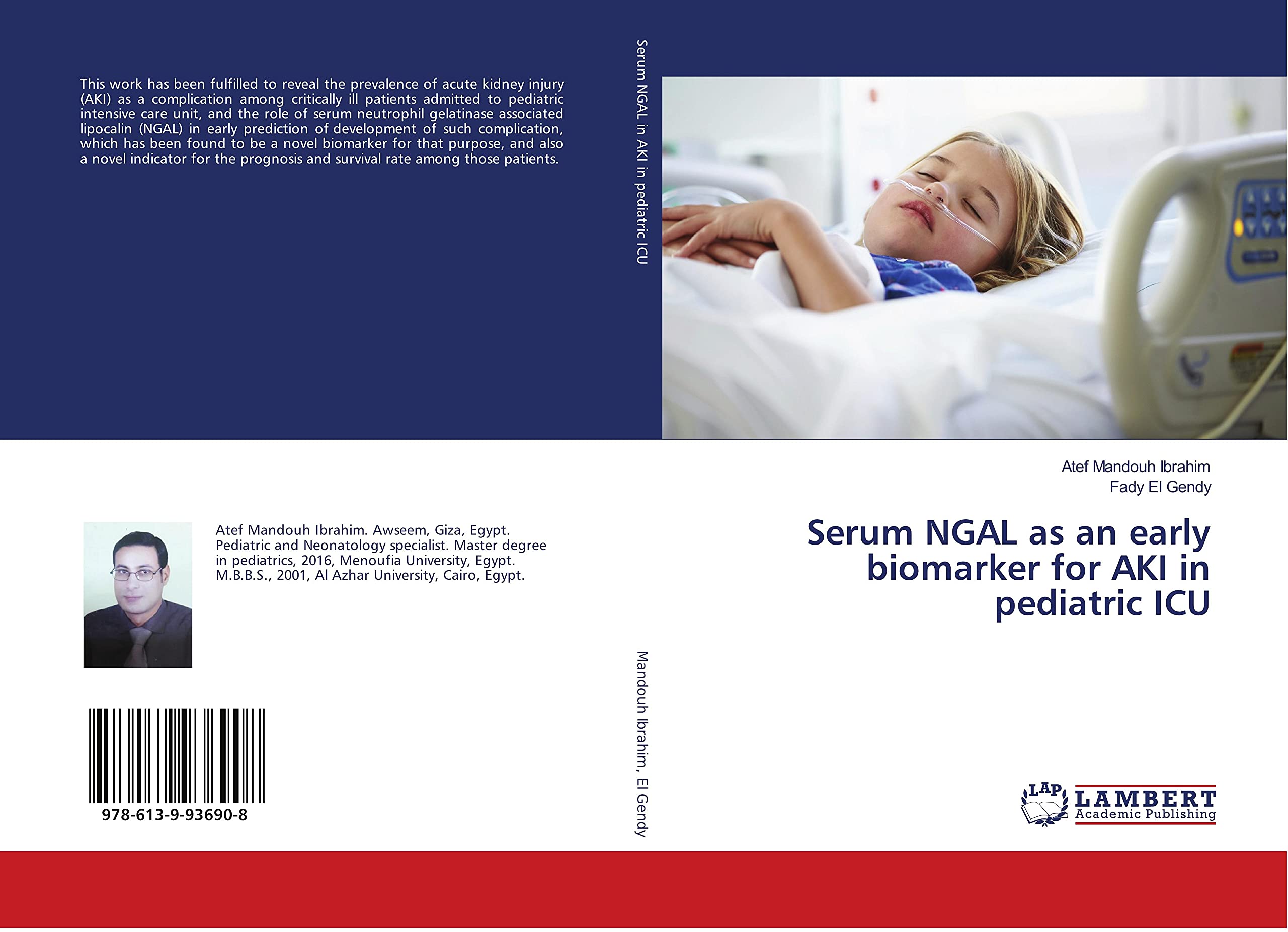Serum NGAL as an early biomarker for AKI in pediatric ICU Medicine