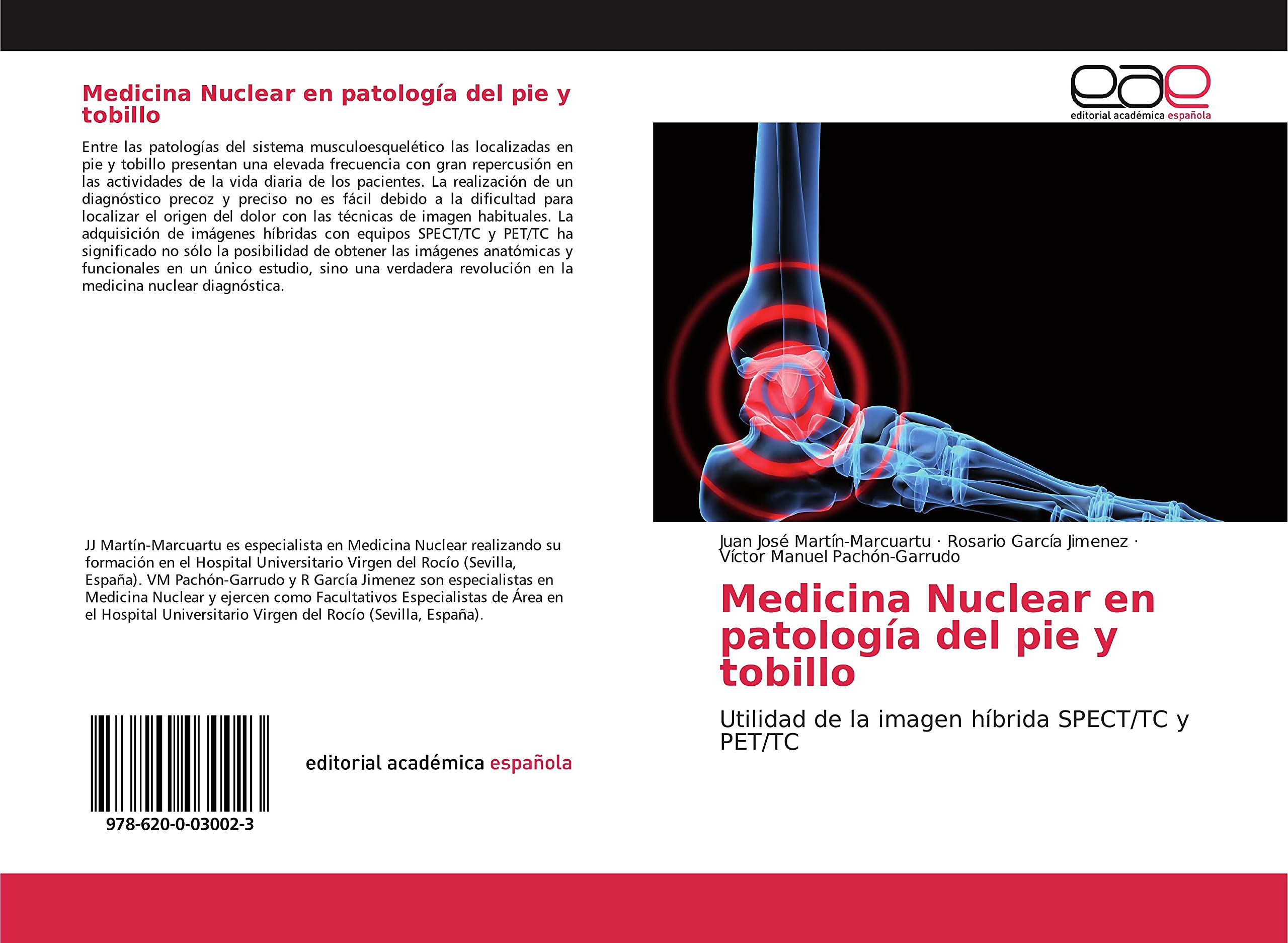 Medicina Nuclear en patología del pie y tobillo: Utilidad de la imagen híbrida SPECT/TC y PET/TC Medicine