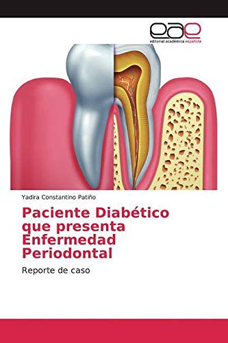 Paciente Diabético que presenta Enfermedad Periodontal: Reporte de caso Medicine