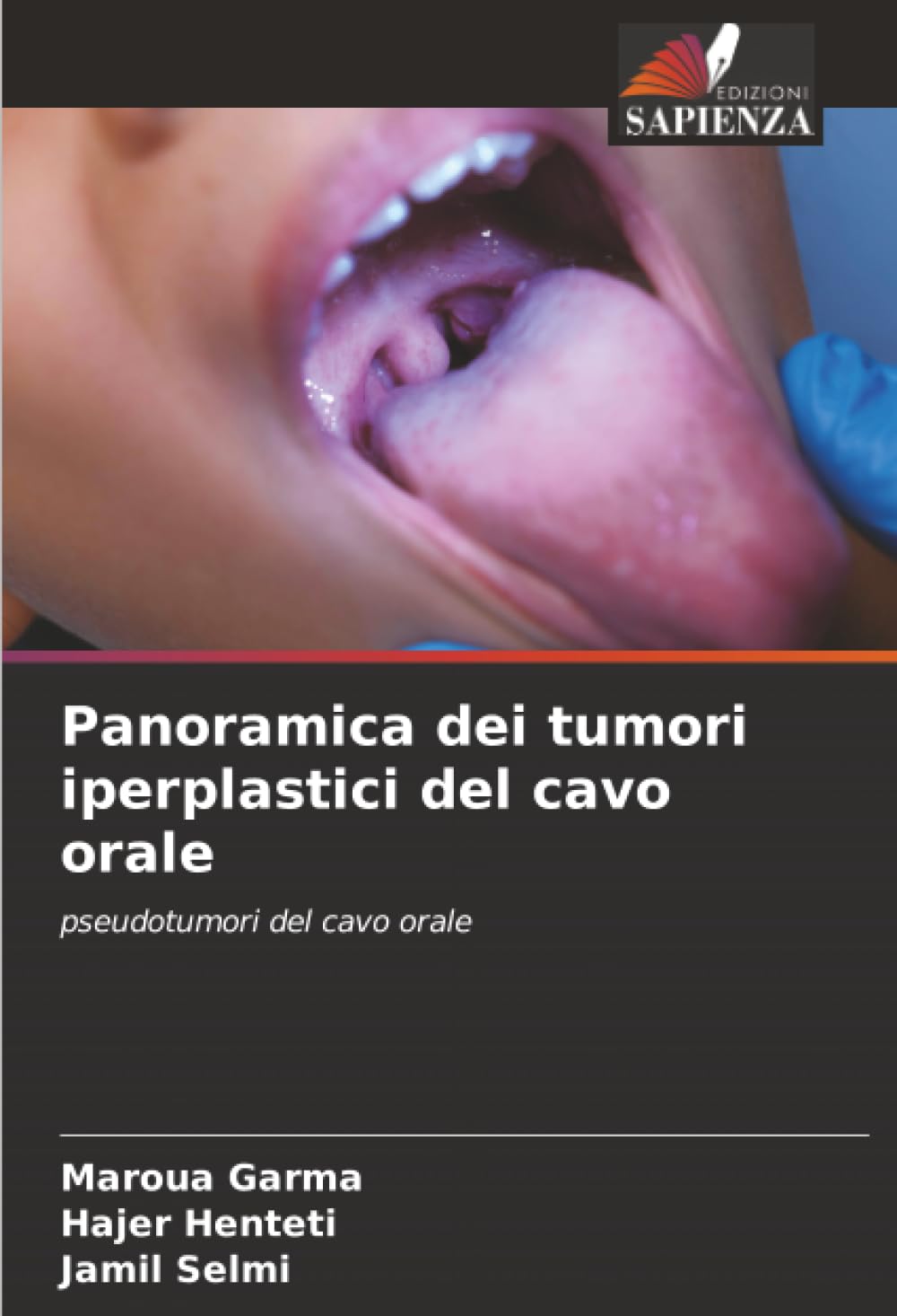 Panoramica dei tumori iperplastici del cavo orale Medicine