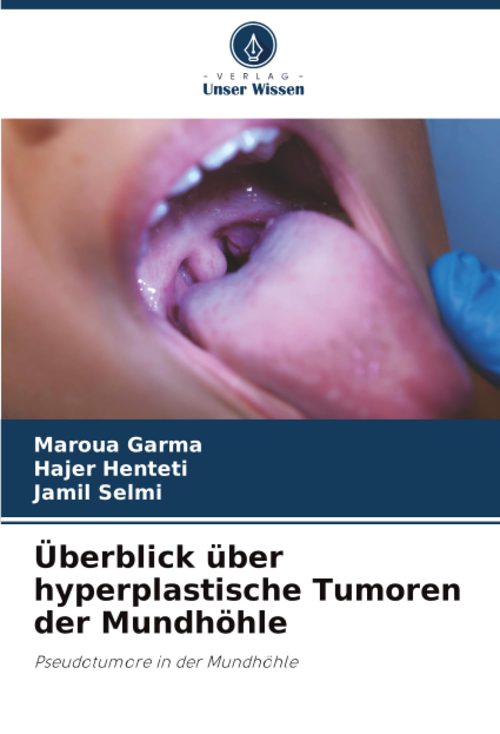 Überblick über hyperplastische Tumoren der Mundhöhle Medicine