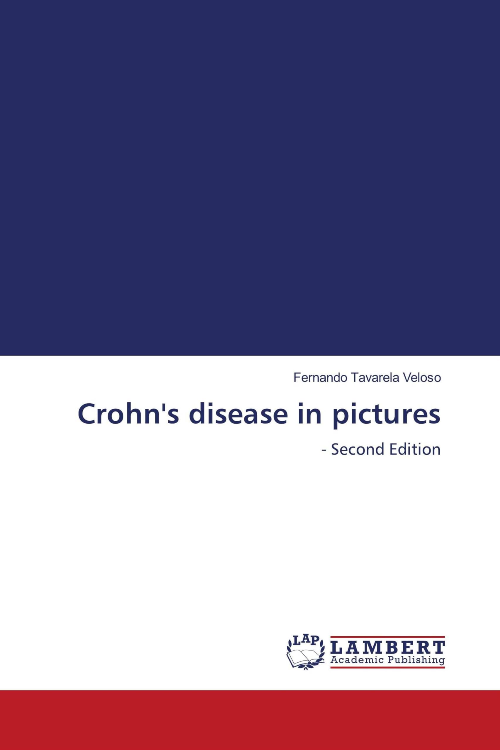 Crohn's disease in pictures Medicine