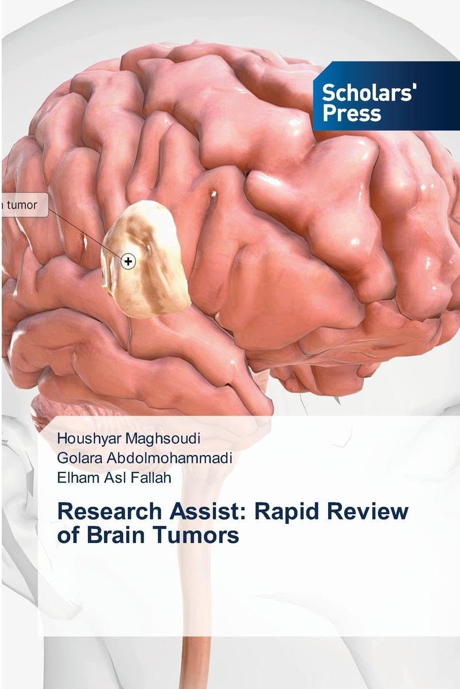 Research Assist: Rapid Review of Brain Tumors Medicine