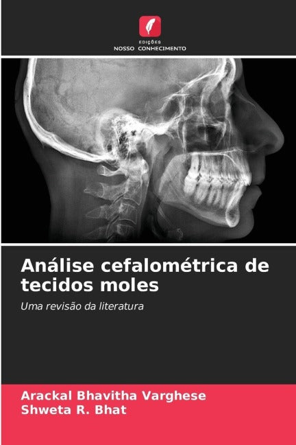 Análise cefalométrica de tecidos moles Medicine