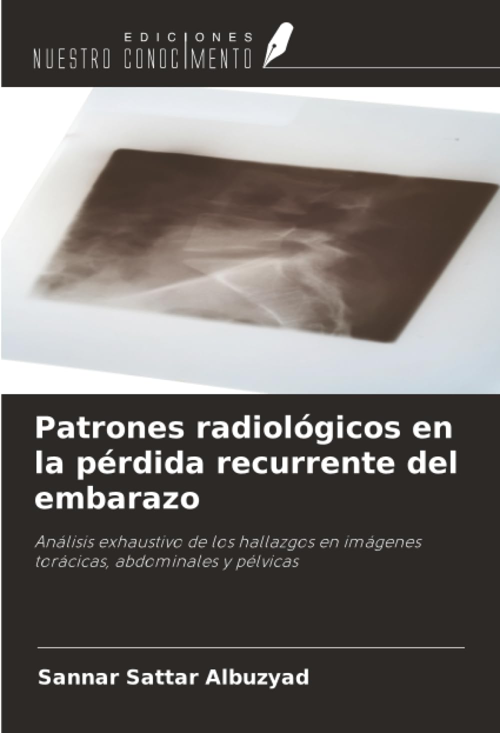 Patrones radiológicos en la pérdida recurrente del embarazo Medicine