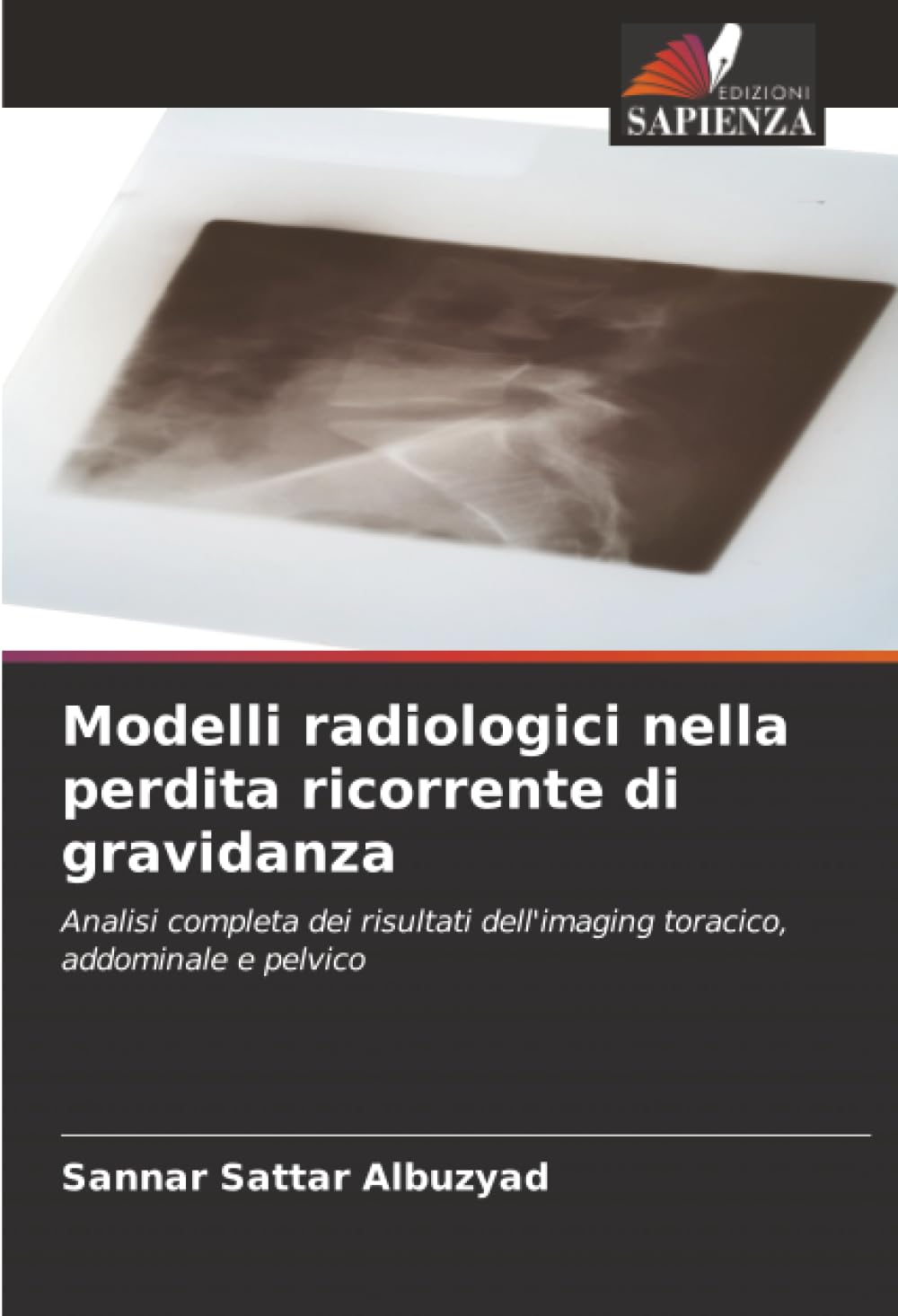 Modelli radiologici nella perdita ricorrente di gravidanza Medicine