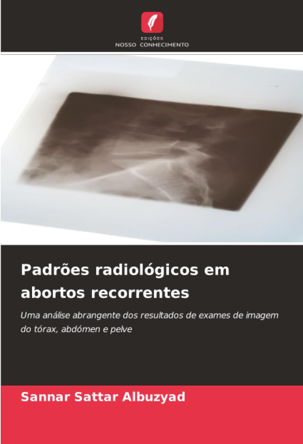 Padrões radiológicos em abortos recorrentes Medicine