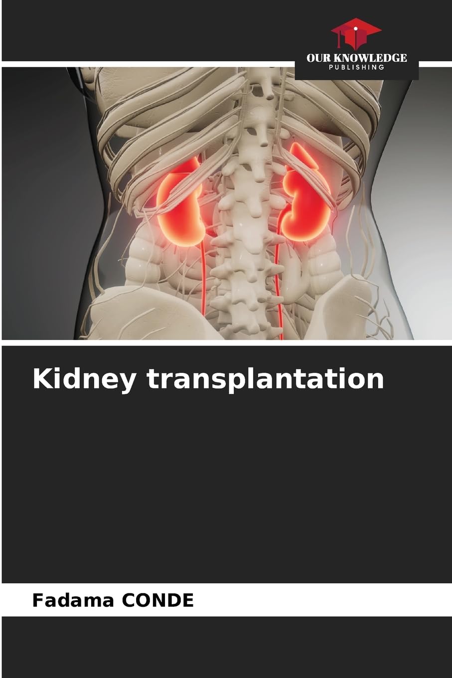 Kidney transplantation Medicine
