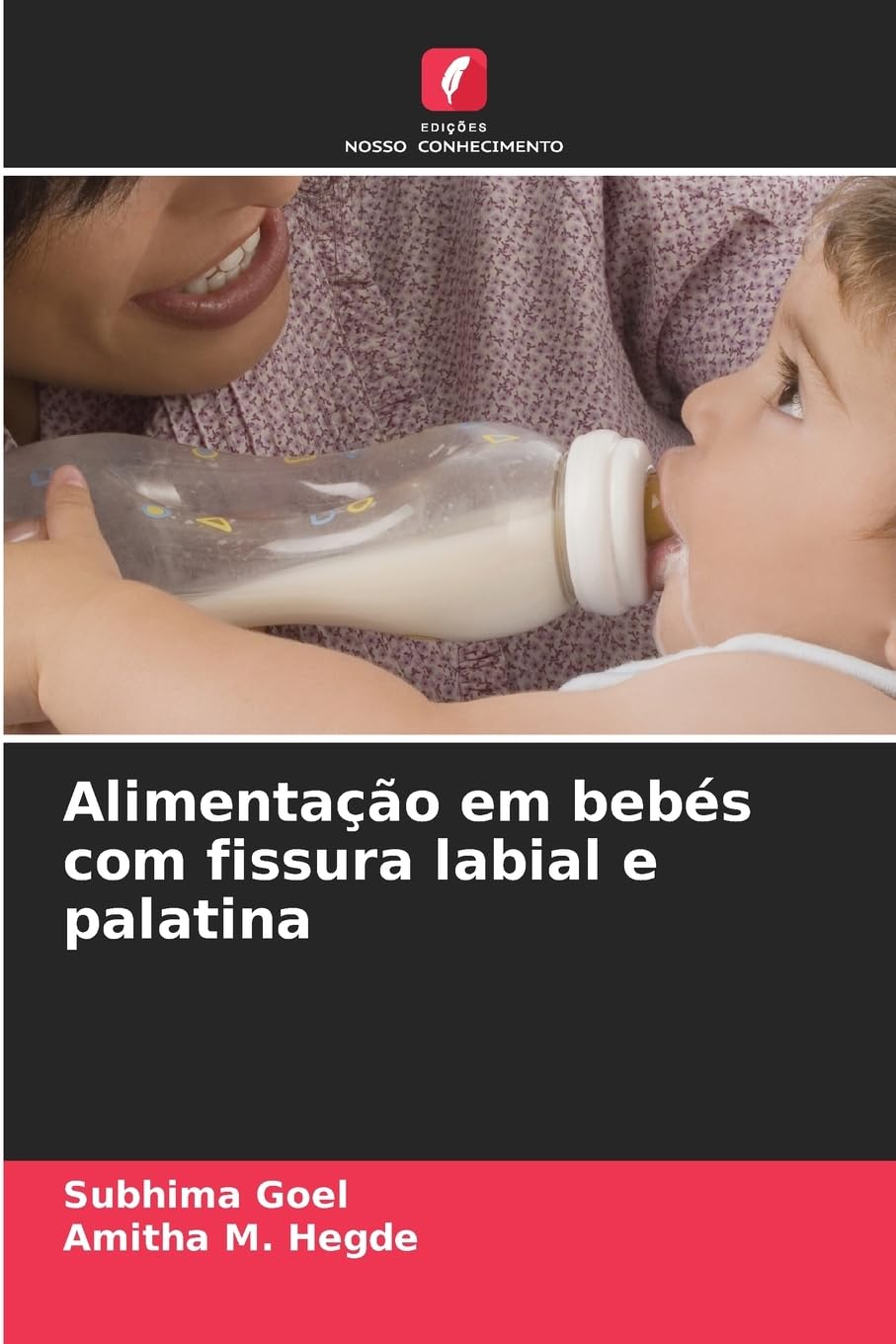 Alimentação em bebés com fissura labial e palatina Medicine