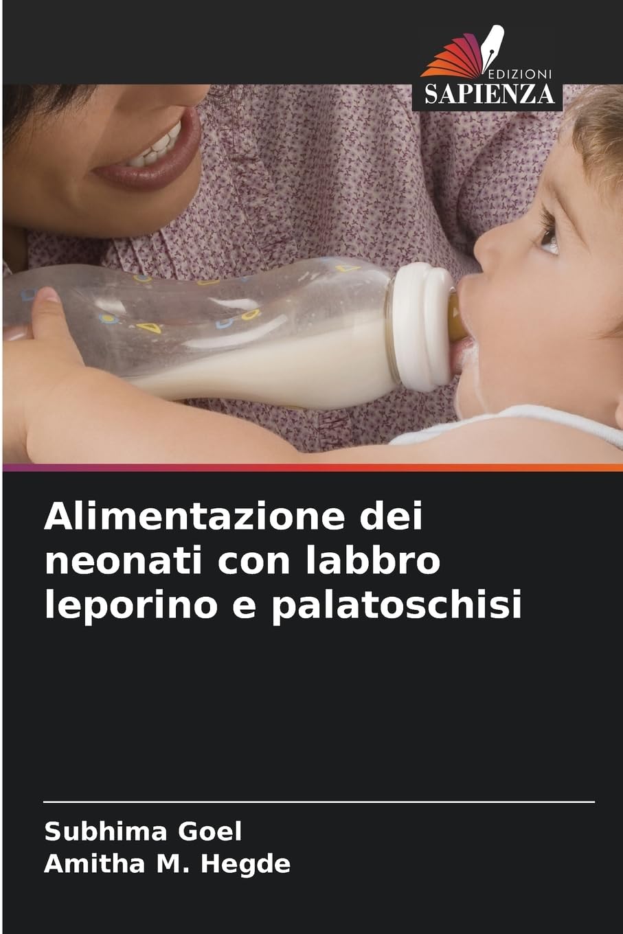 Alimentazione dei neonati con labbro leporino e palatoschisi Medicine