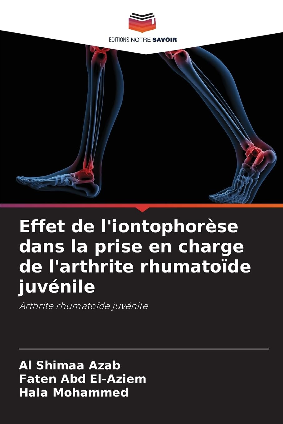 Effet de l'iontophorèse dans la prise en charge de l'arthrite rhumatoïde juvénile: Arthrite rhumatoïde juvénile Medicine