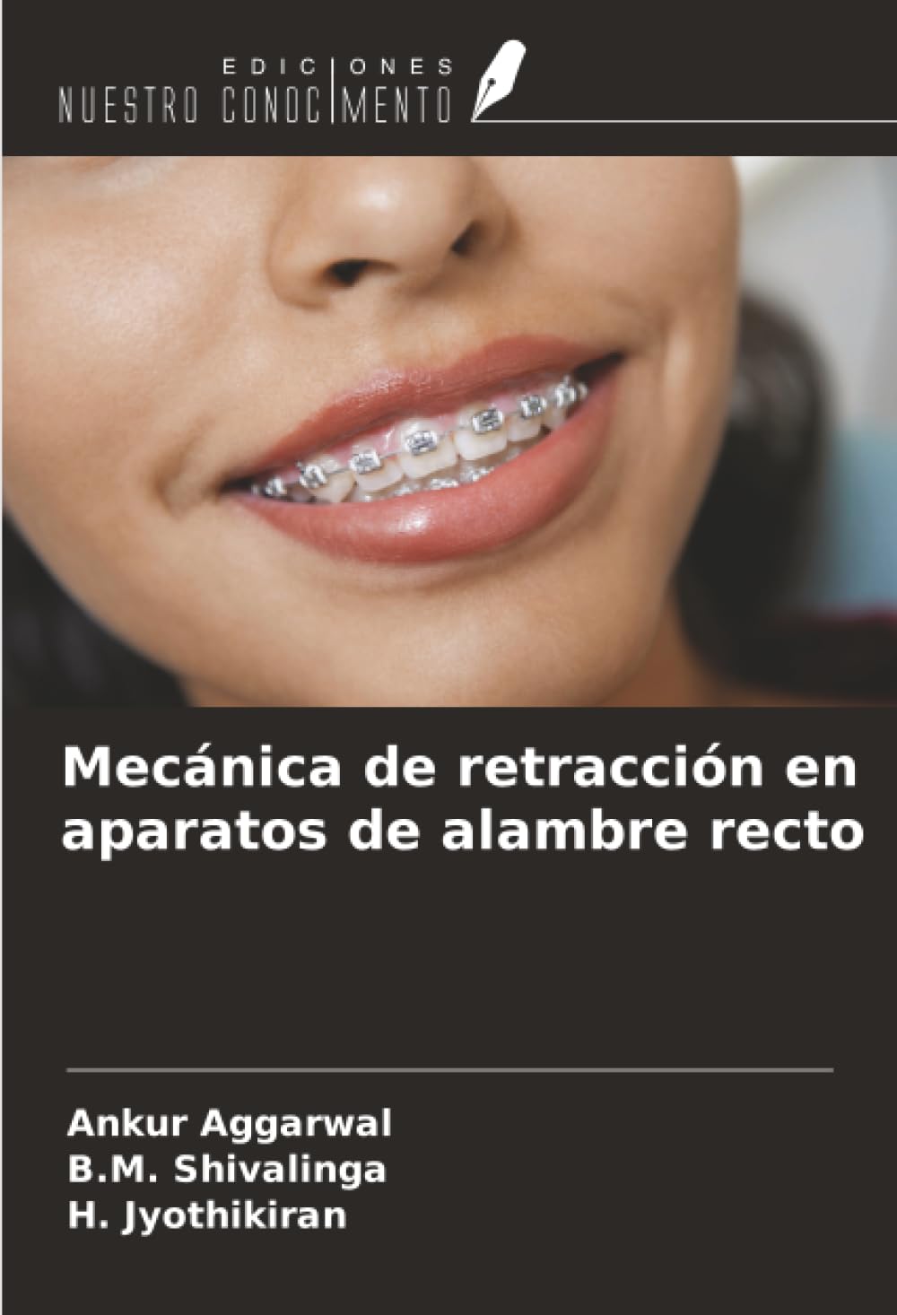 Mecánica de retracción en aparatos de alambre recto Medicine