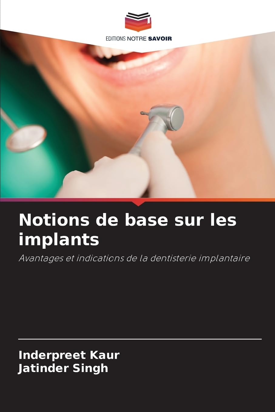 Notions de base sur les implants: Avantages et indications de la dentisterie implantaire Medicine