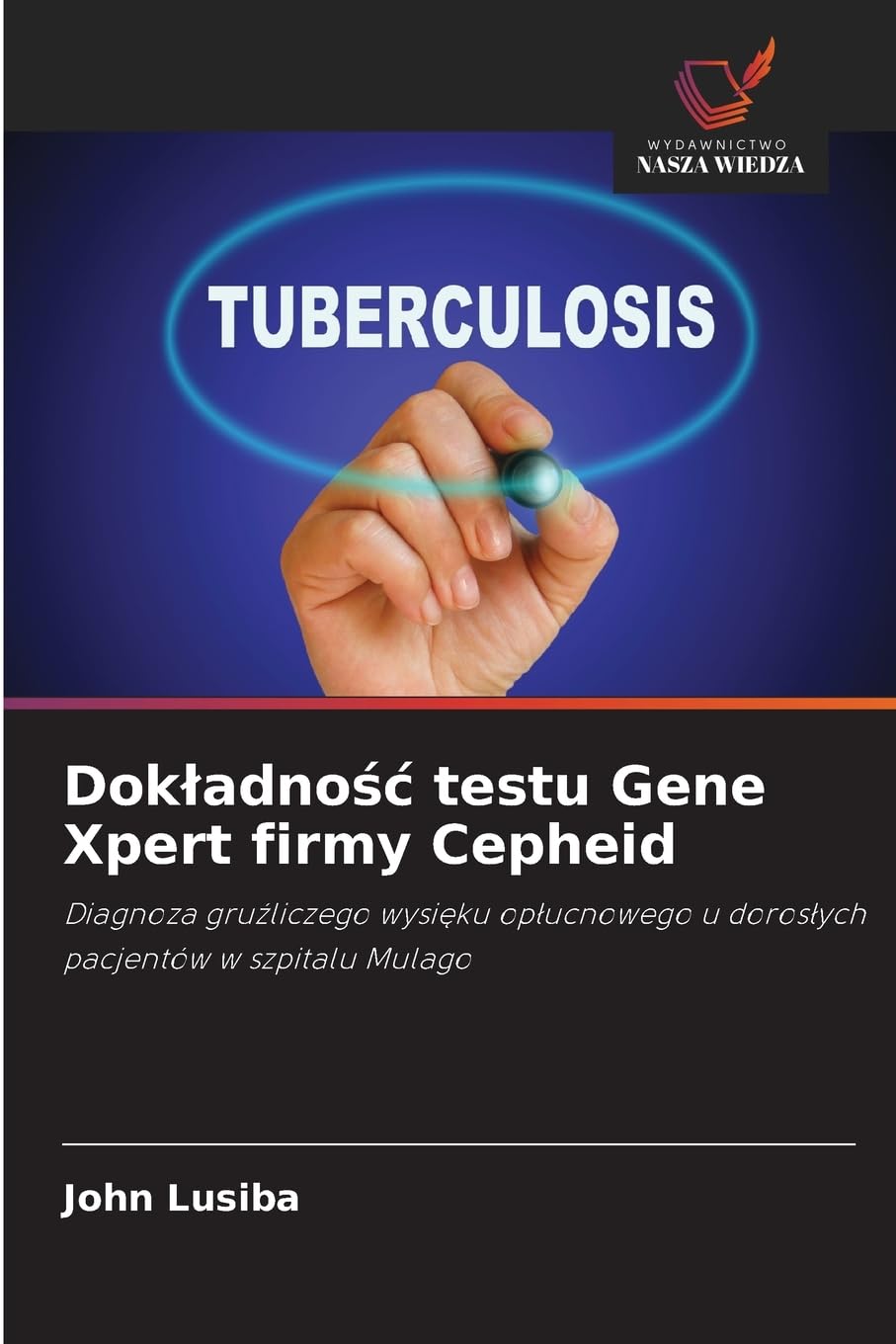 Dok¿adno¿¿ testu Gene Xpert firmy Cepheid Natural Sciences