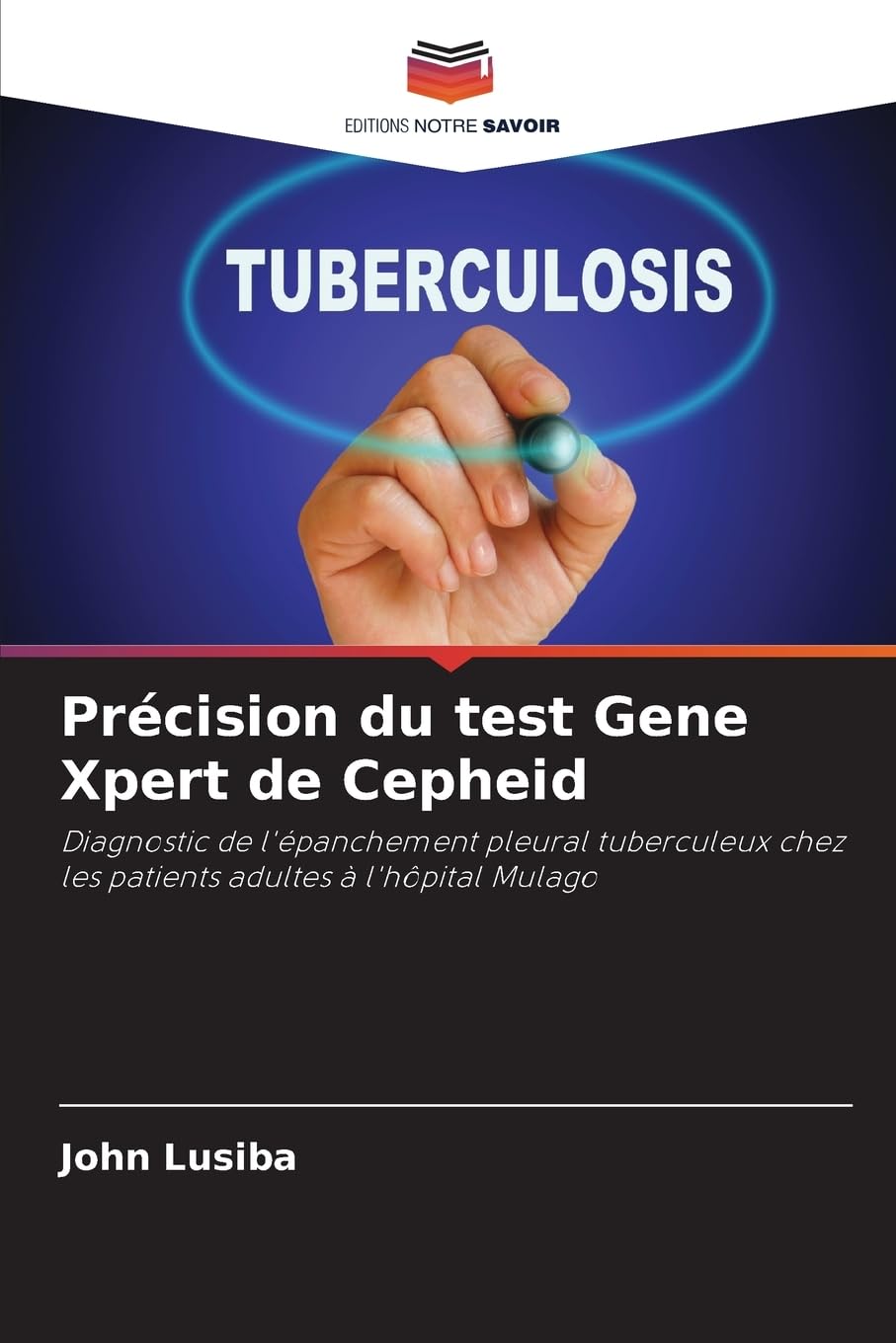 Précision du test Gene Xpert de Cepheid: Diagnostic de l'épanchement pleural tuberculeux chez les patients adultes à l'hôpital Mulago Natural Sciences