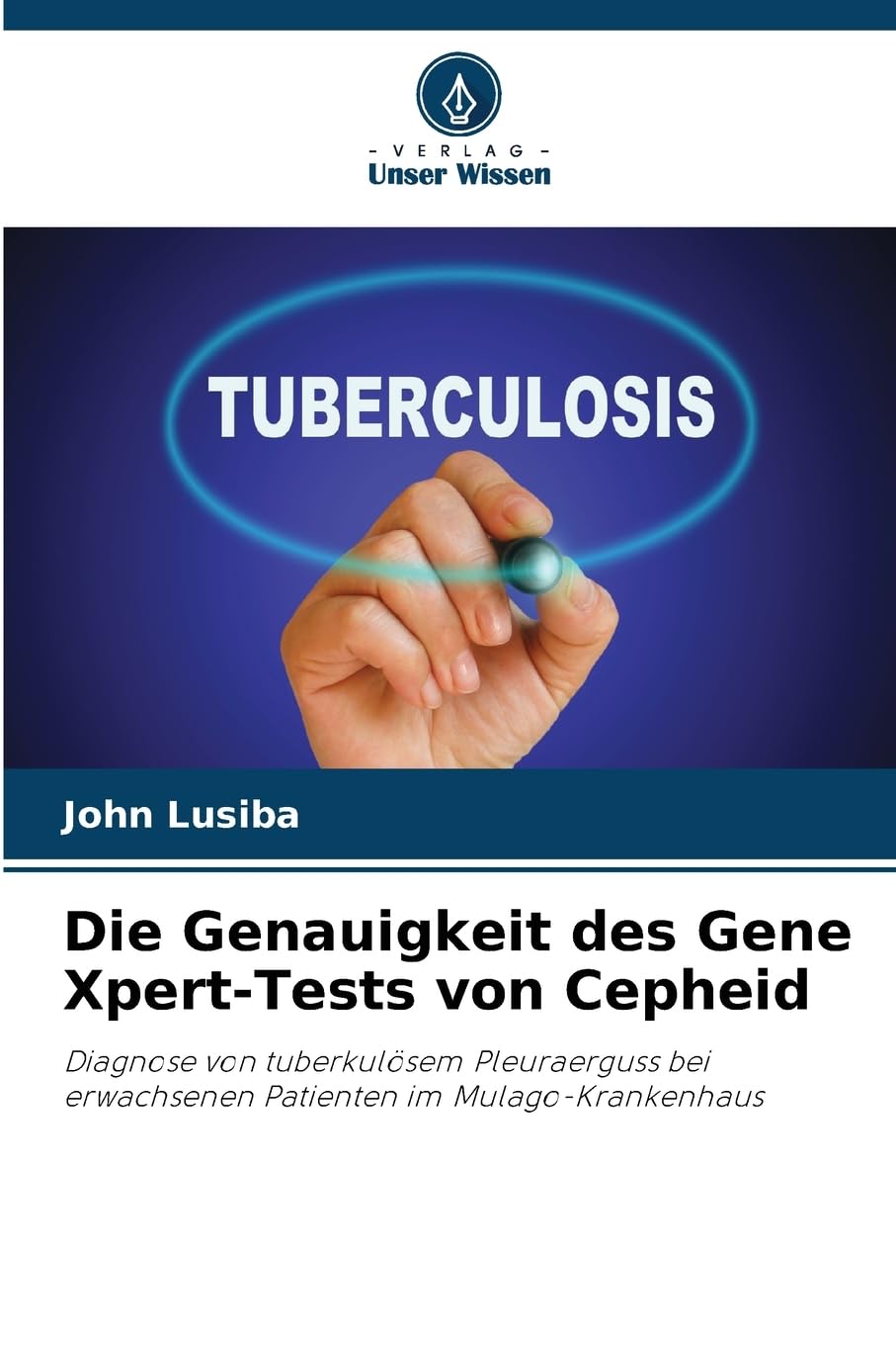 Die Genauigkeit des Gene Xpert-Tests von Cepheid Natural Sciences