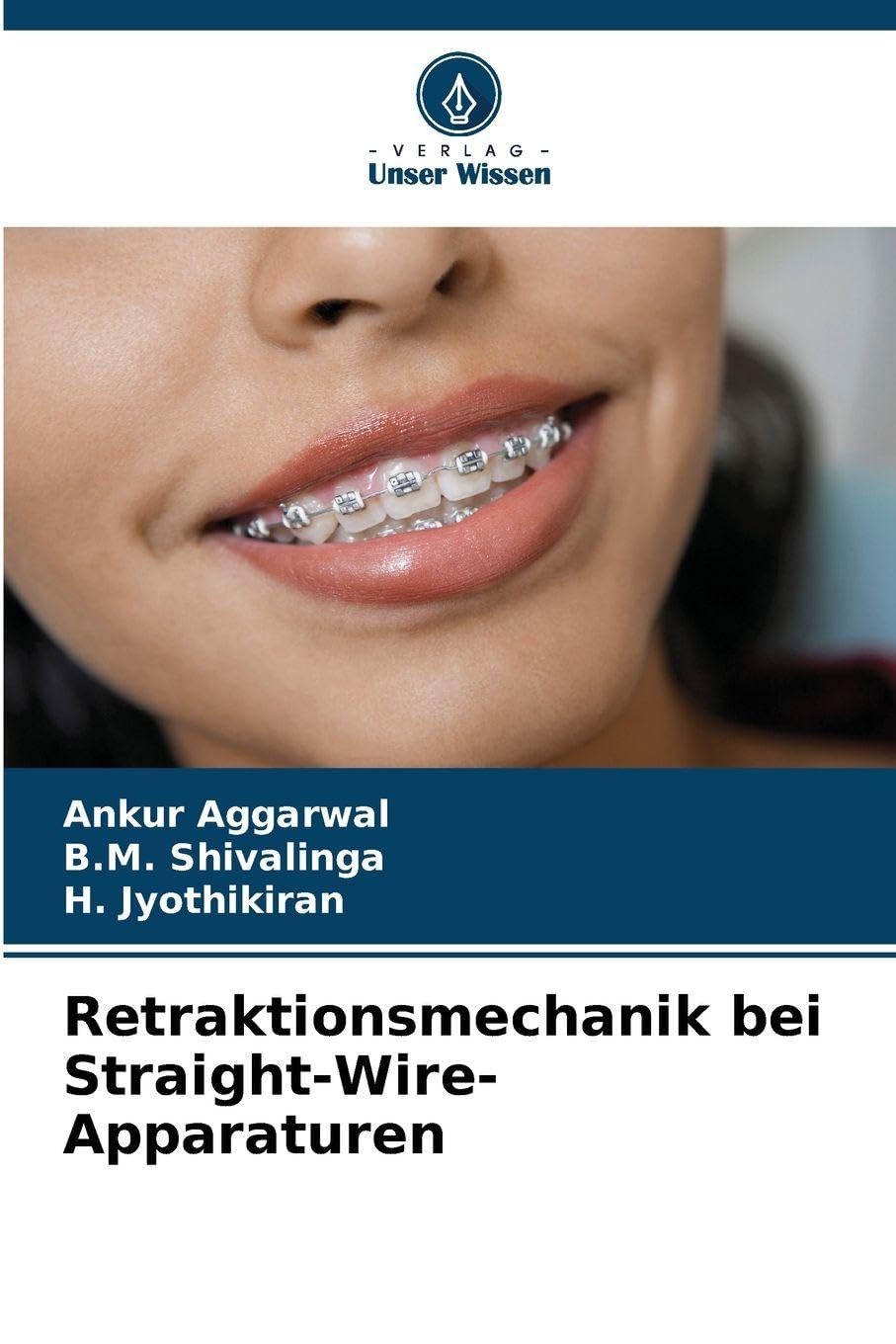 Retraktionsmechanik bei Straight-Wire-Apparaturen Medicine