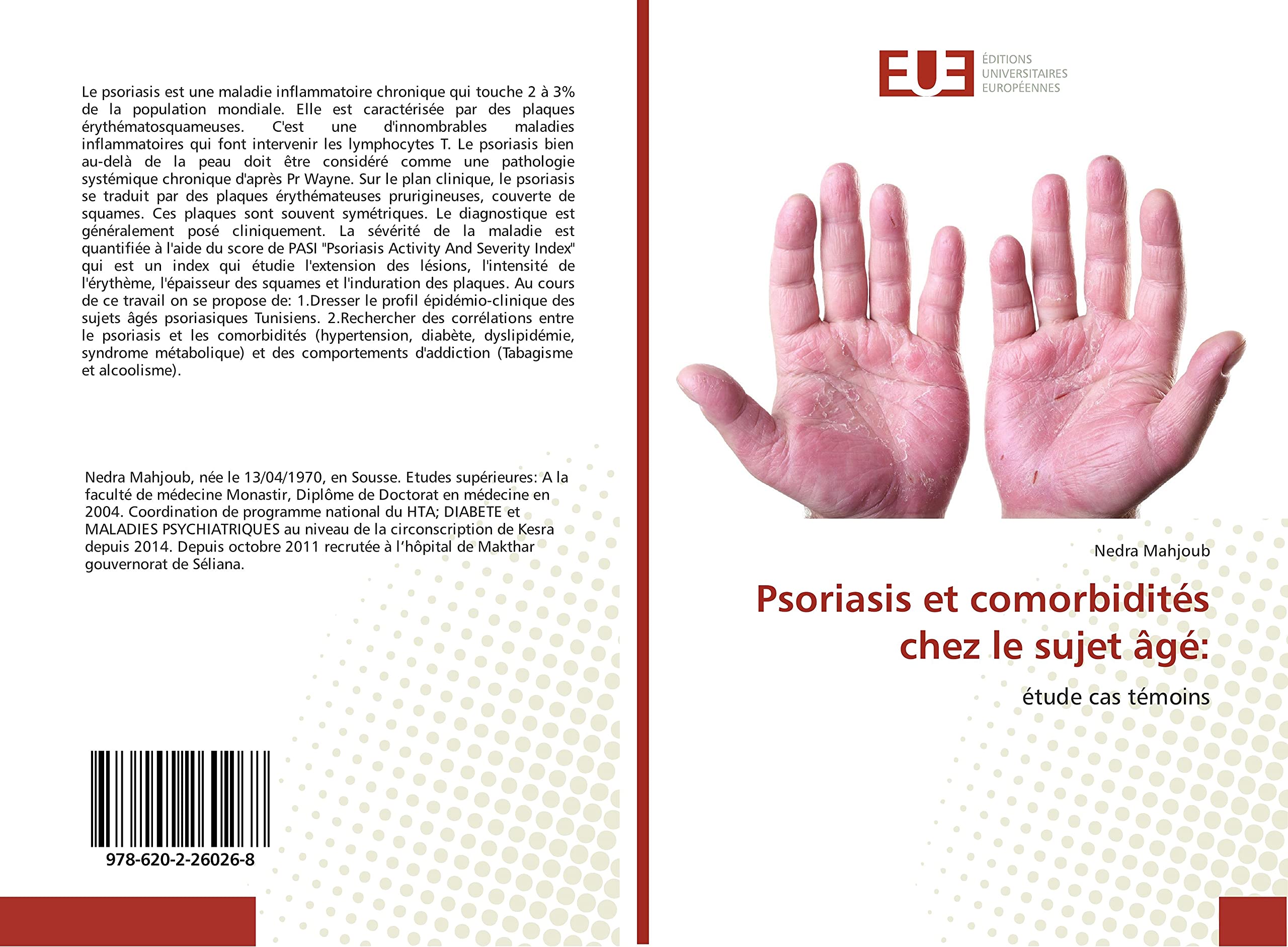 Psoriasis et comorbidités chez le sujet âgé:: étude cas témoins book