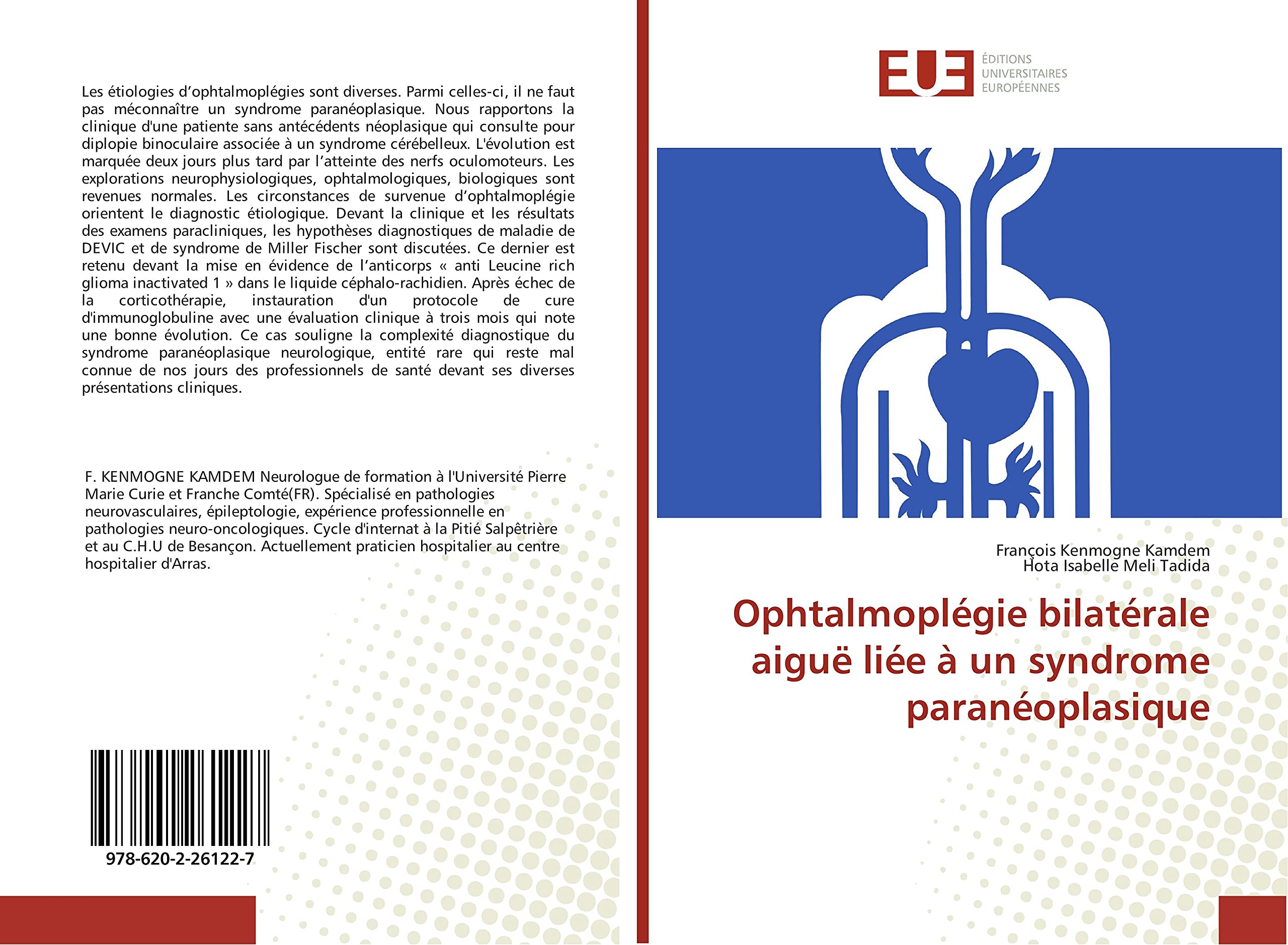 Ophtalmoplegie bilaterale aiguë liee A un syndrome paraneoplasique book
