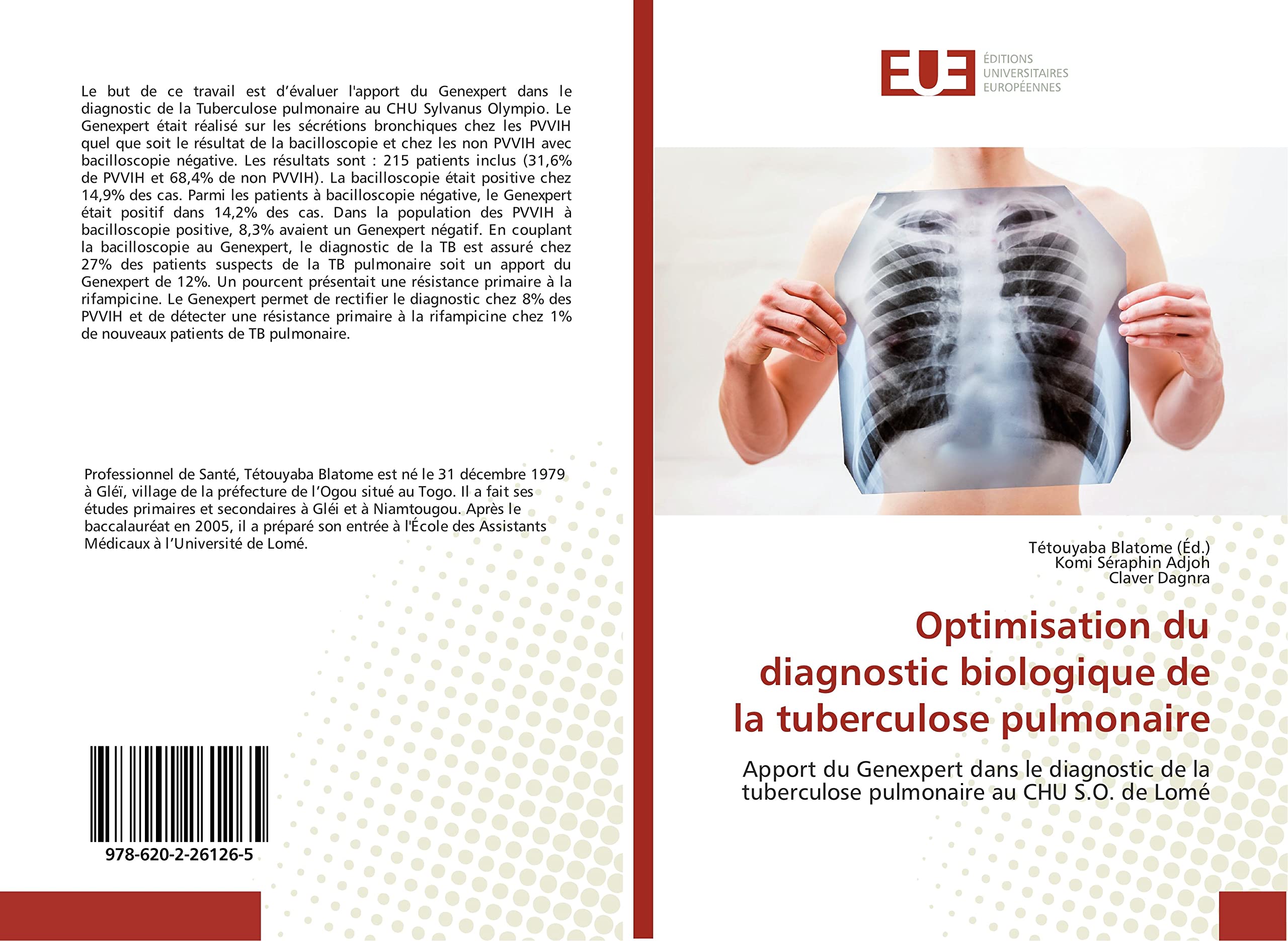 Optimisation du diagnostic biologique de la tuberculose pulmonaire: Apport du Genexpert dans le diagnostic de la tuberculose pulmonaire au CHU S.O. de Lomé book