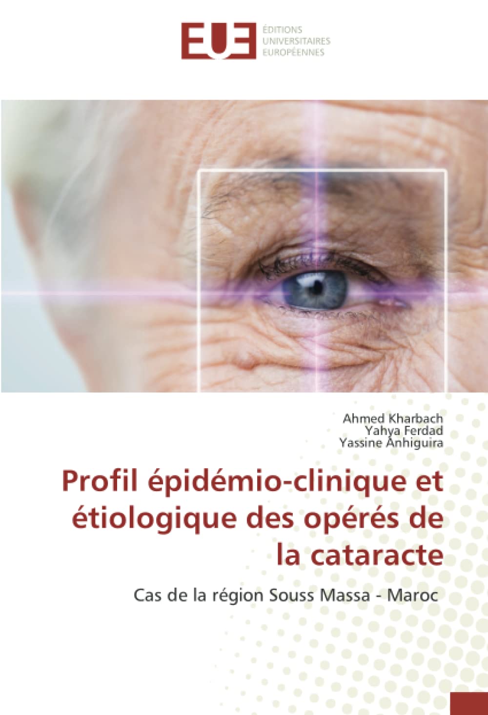 Profil épidémio-clinique et étiologique des opérés de la cataracte: Cas de la région Souss Massa - Maroc book