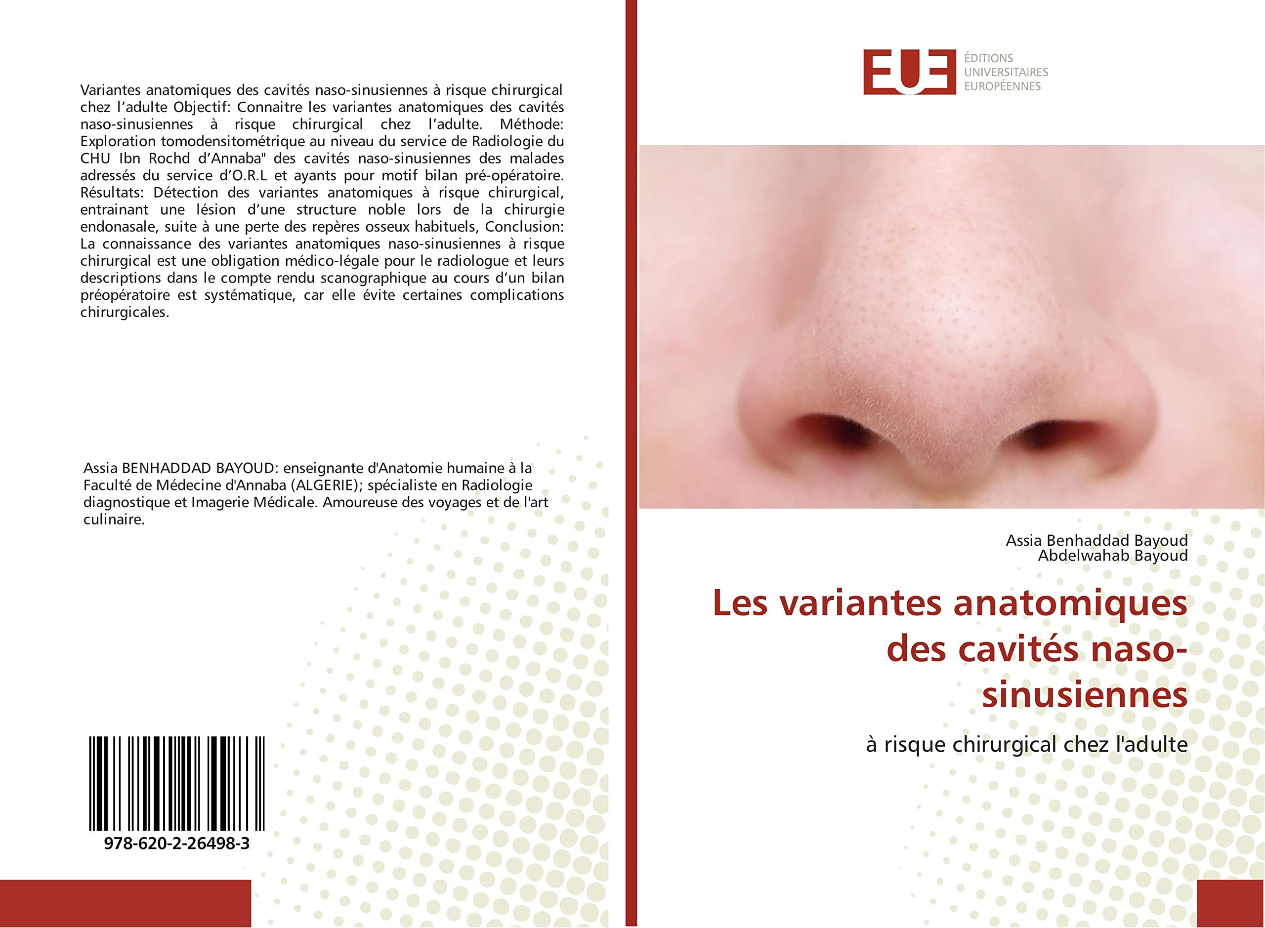 Les variantes anatomiques des cavités naso-sinusiennes: à risque chirurgical chez l'adulte book