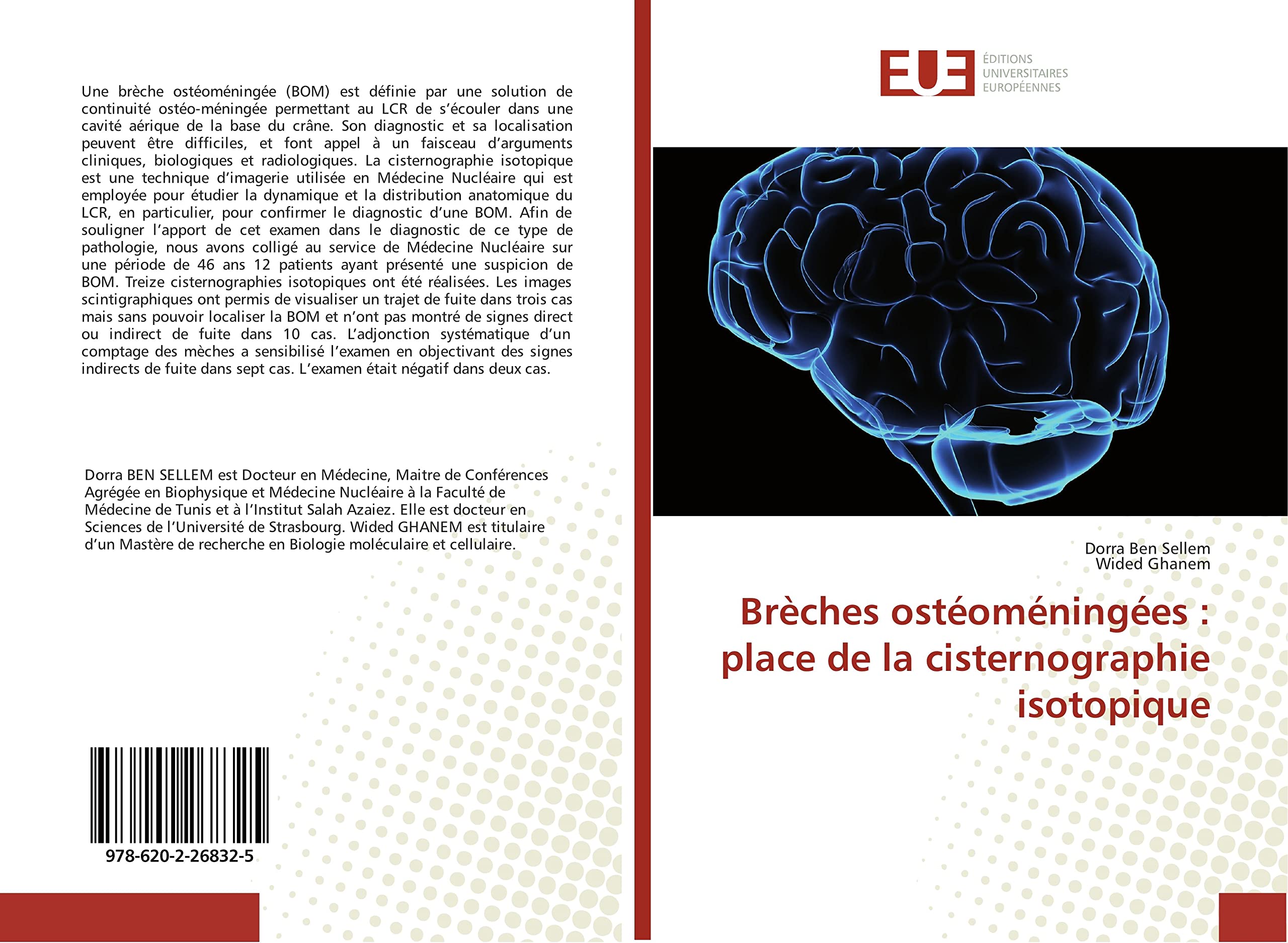 Brèches ostéoméningées : place de la cisternographie isotopique book